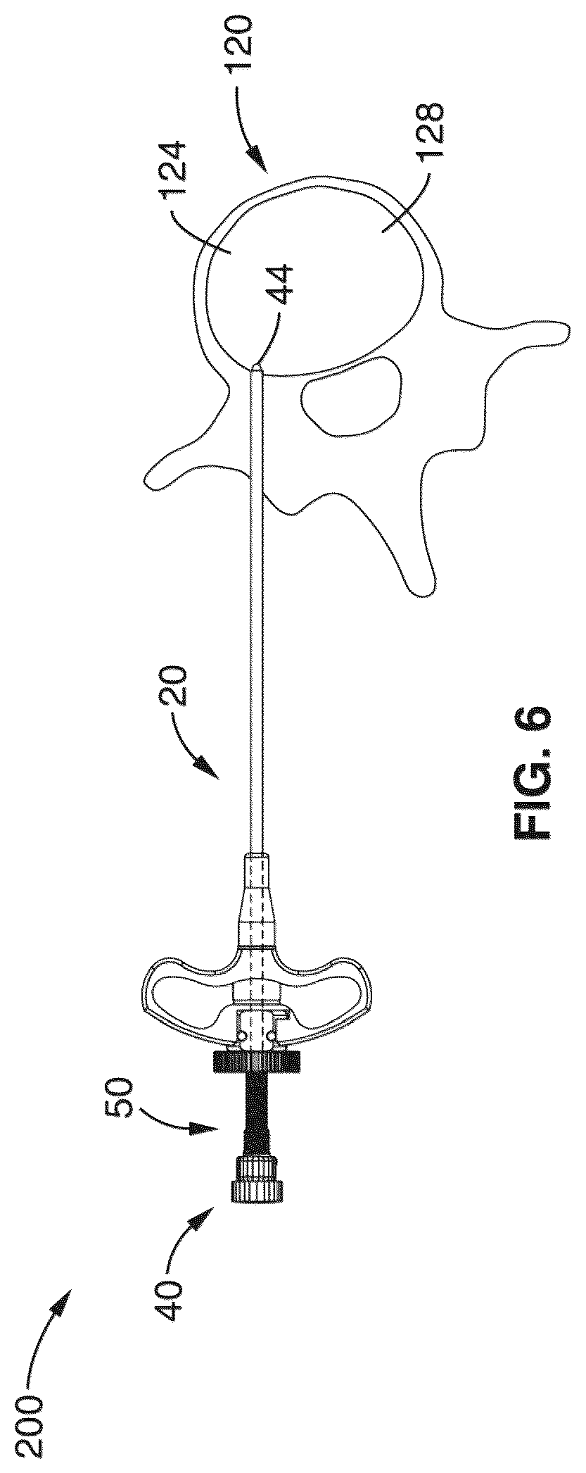 Patent US12303166 Figure 8 – Methods for accessing nerves within bone