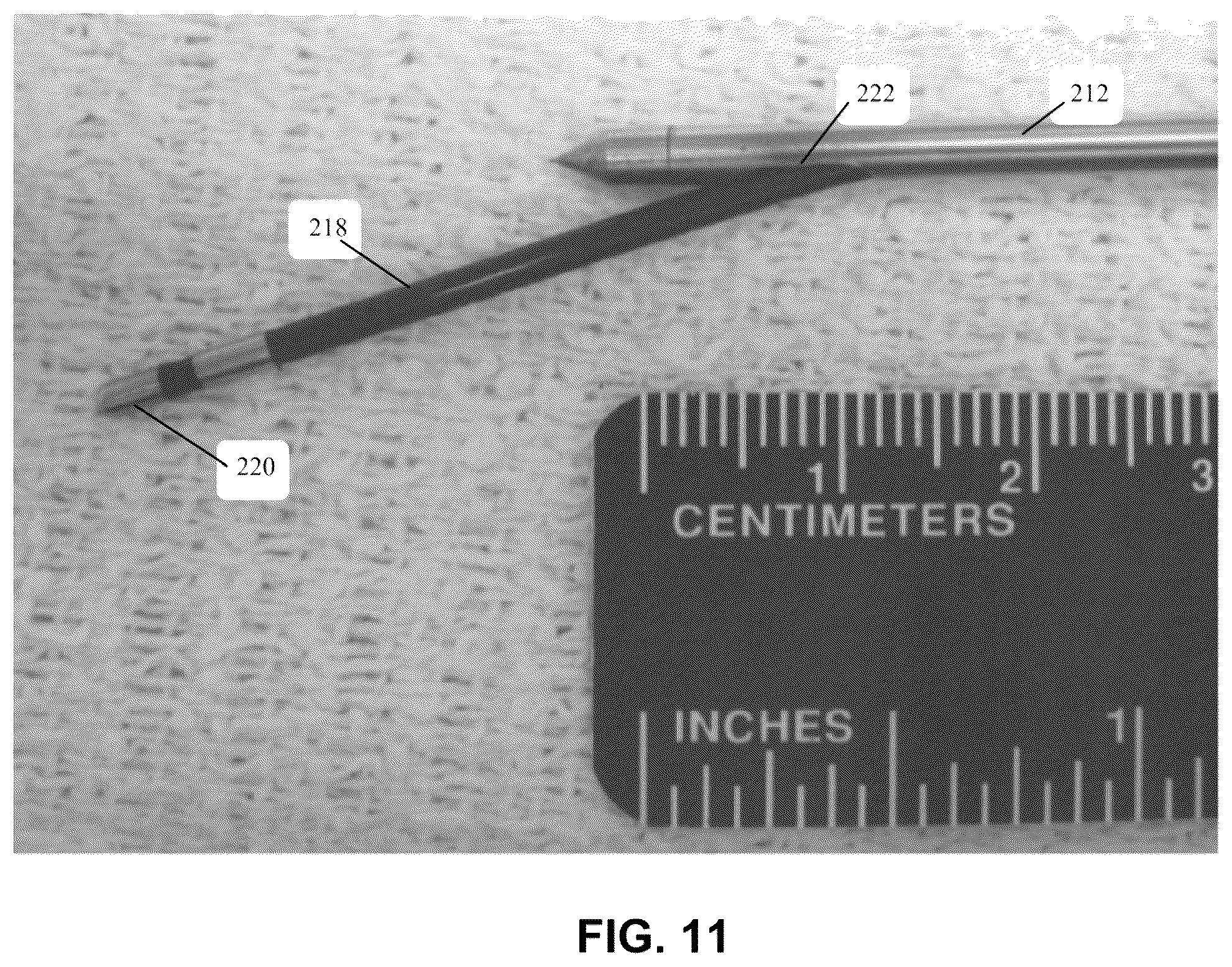 Patent US12303166 Figure 13 – Methods for accessing nerves within bone