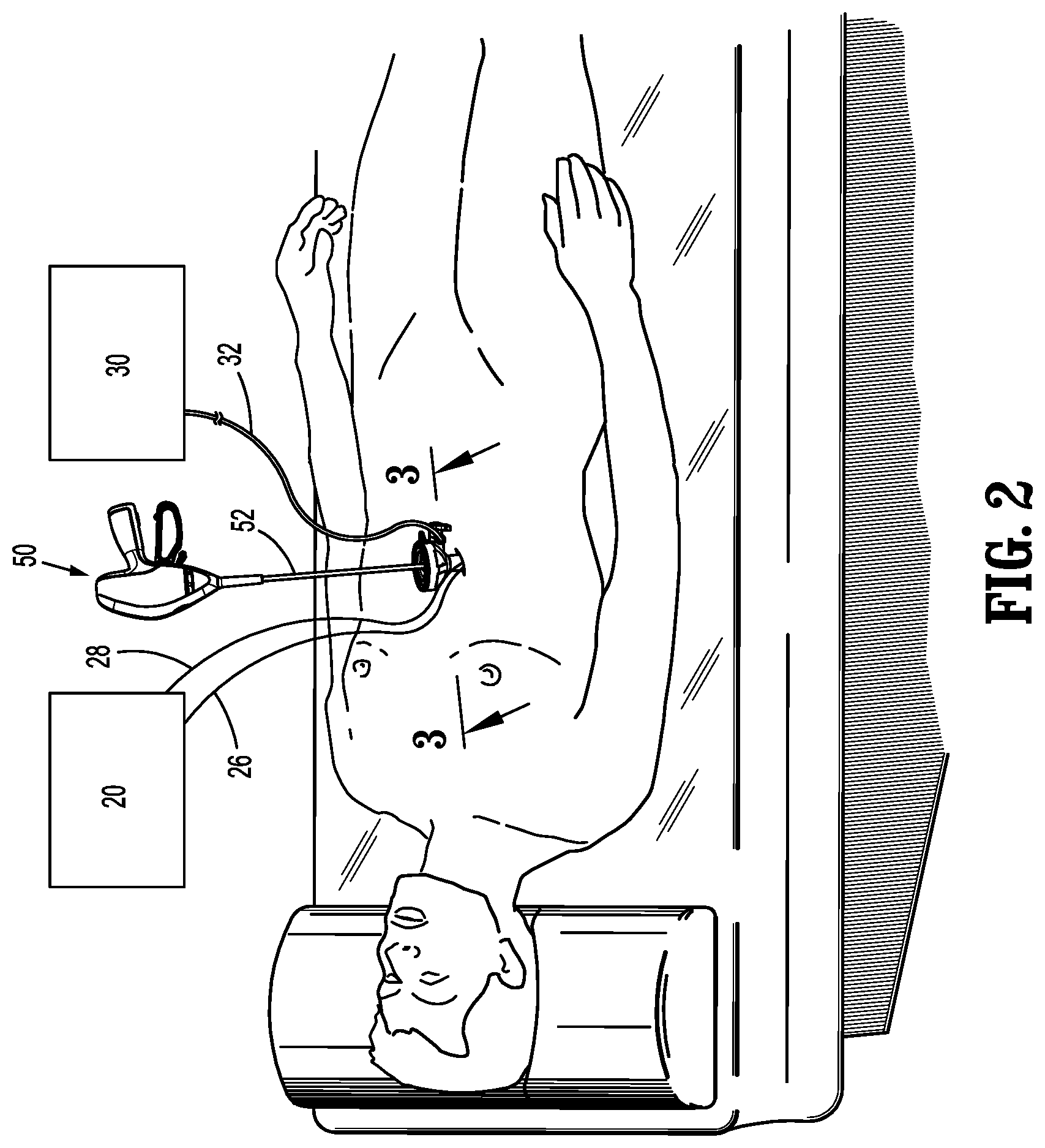 Patent US12303167 Figure 2 – Surgical access device with active smoke filtration