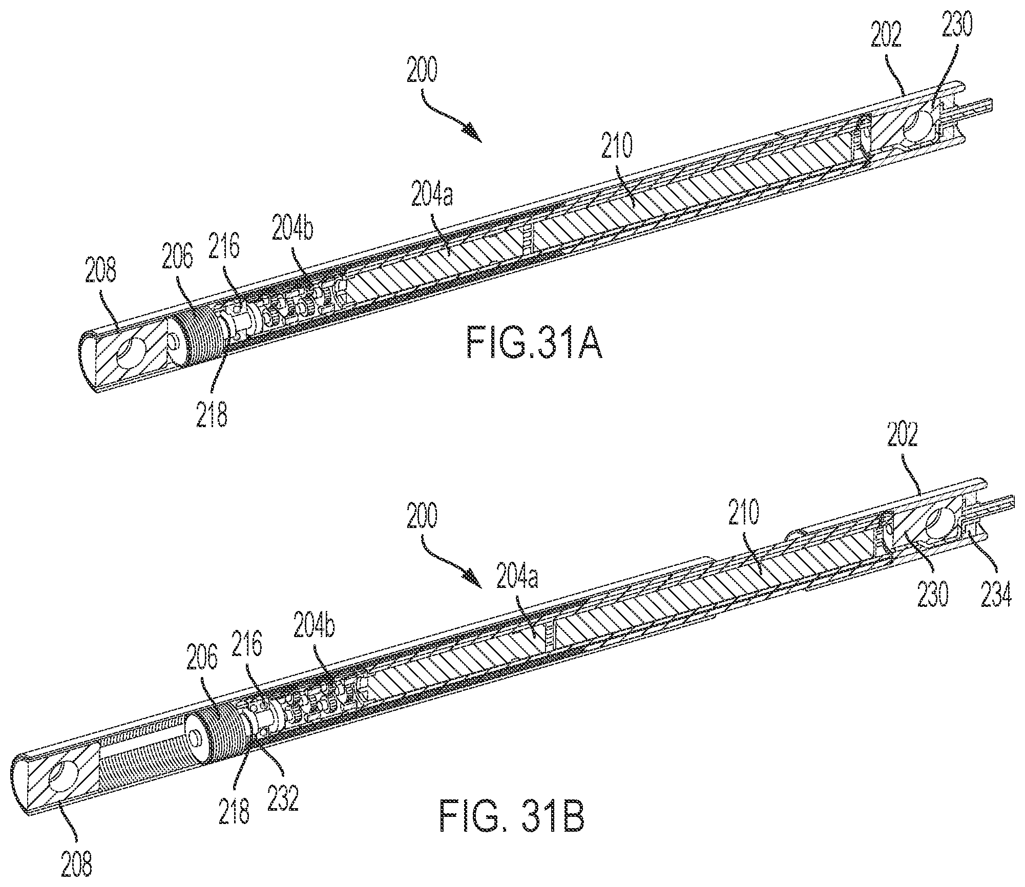 Patent US12303169 Figure 16 – Bone elongating devices and methods of use