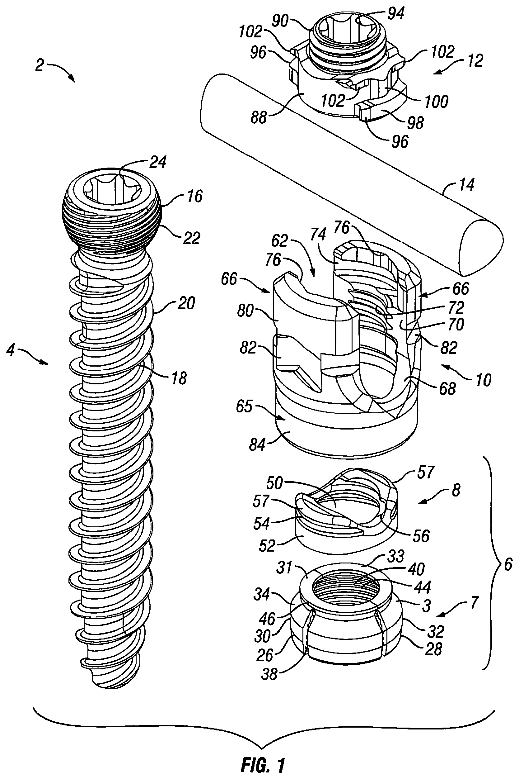Patent US12303170 Figure 1 – Orthopedic fixation devices and methods of installation thereof