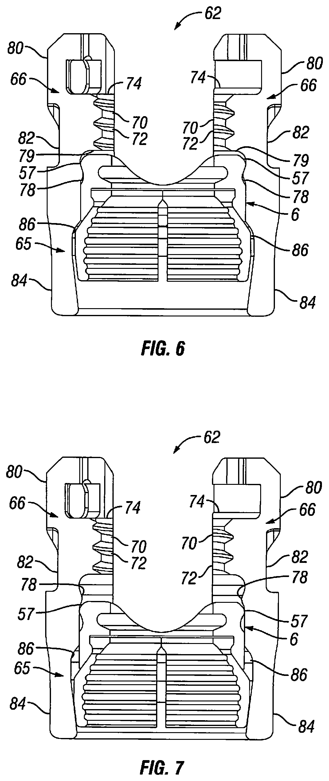 Patent US12303170 Figure 4 – Orthopedic fixation devices and methods of installation thereof
