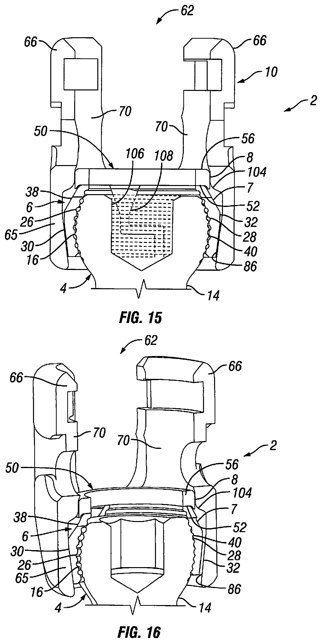 Patent US12303170 Figure 8 – Orthopedic fixation devices and methods of installation thereof
