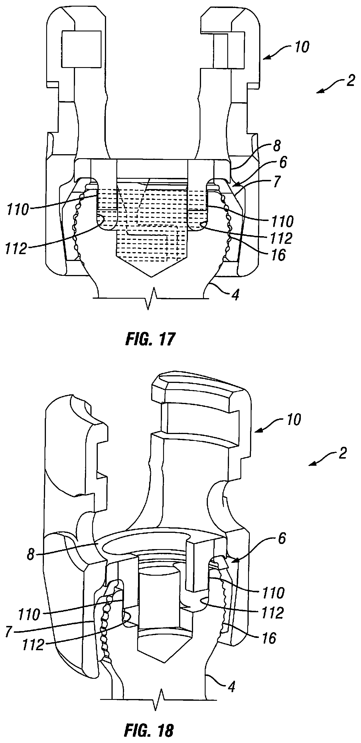 Patent US12303170 Figure 9 – Orthopedic fixation devices and methods of installation thereof