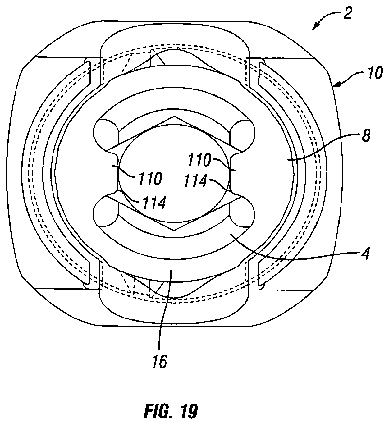 Patent US12303170 Figure 10 – Orthopedic fixation devices and methods of installation thereof