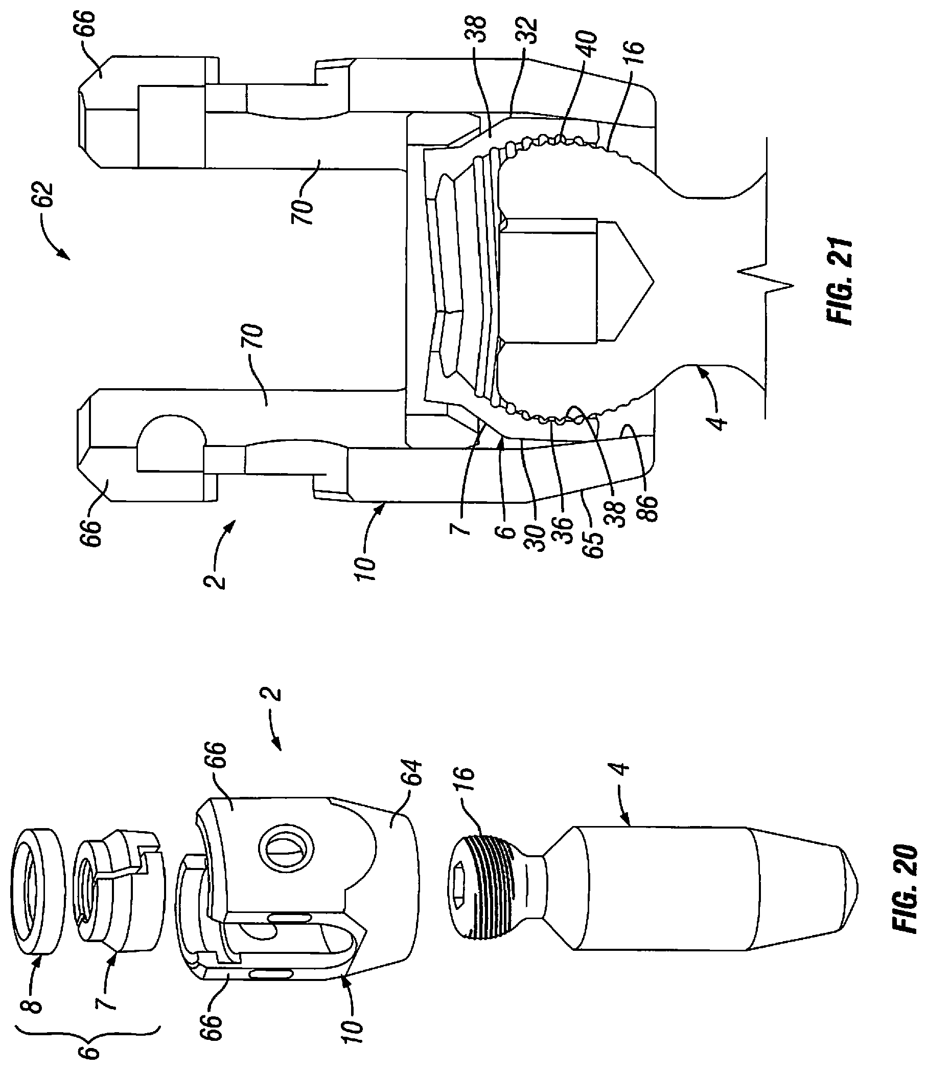 Patent US12303170 Figure 11 – Orthopedic fixation devices and methods of installation thereof