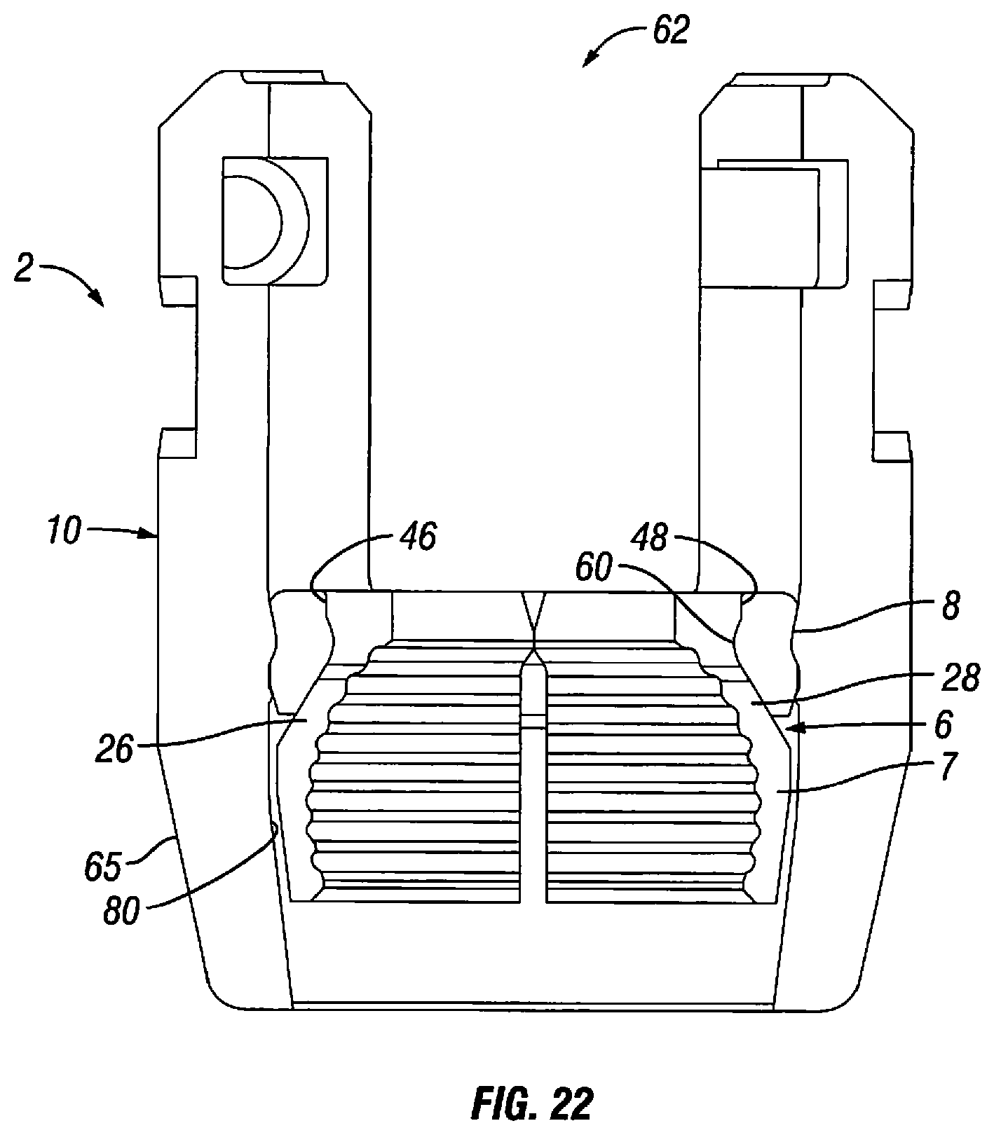 Patent US12303170 Figure 12 – Orthopedic fixation devices and methods of installation thereof