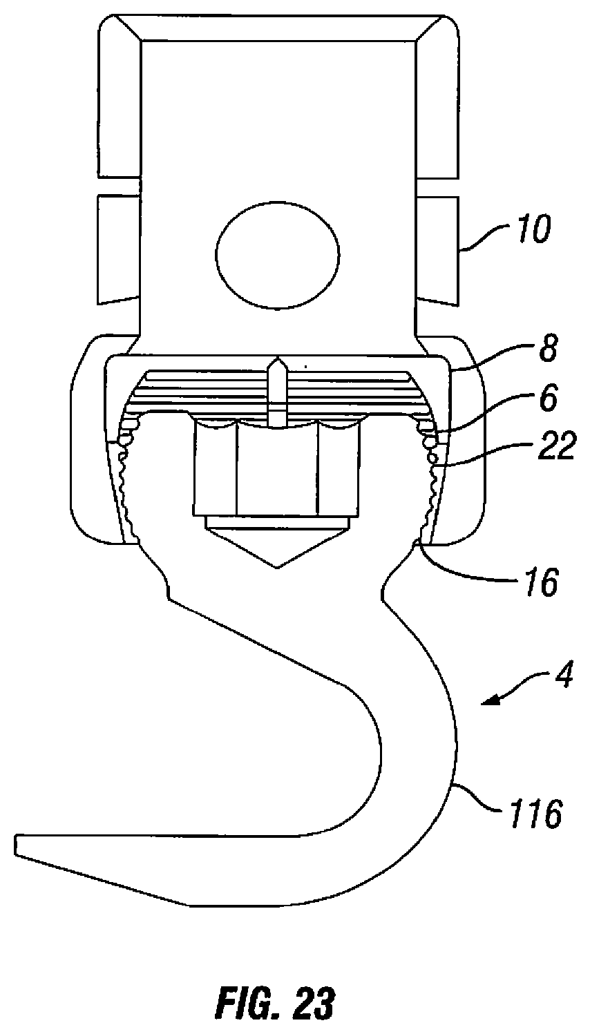 Patent US12303170 Figure 13 – Orthopedic fixation devices and methods of installation thereof