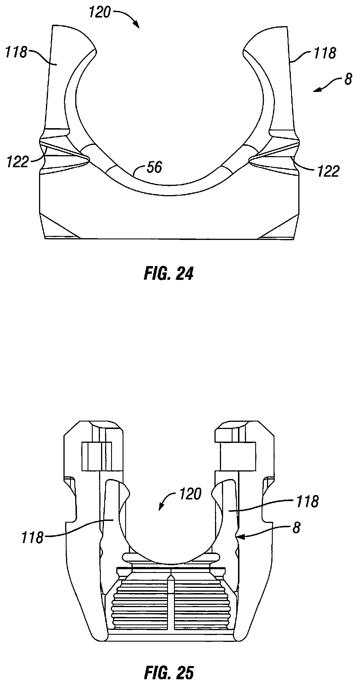 Patent US12303170 Figure 14 – Orthopedic fixation devices and methods of installation thereof