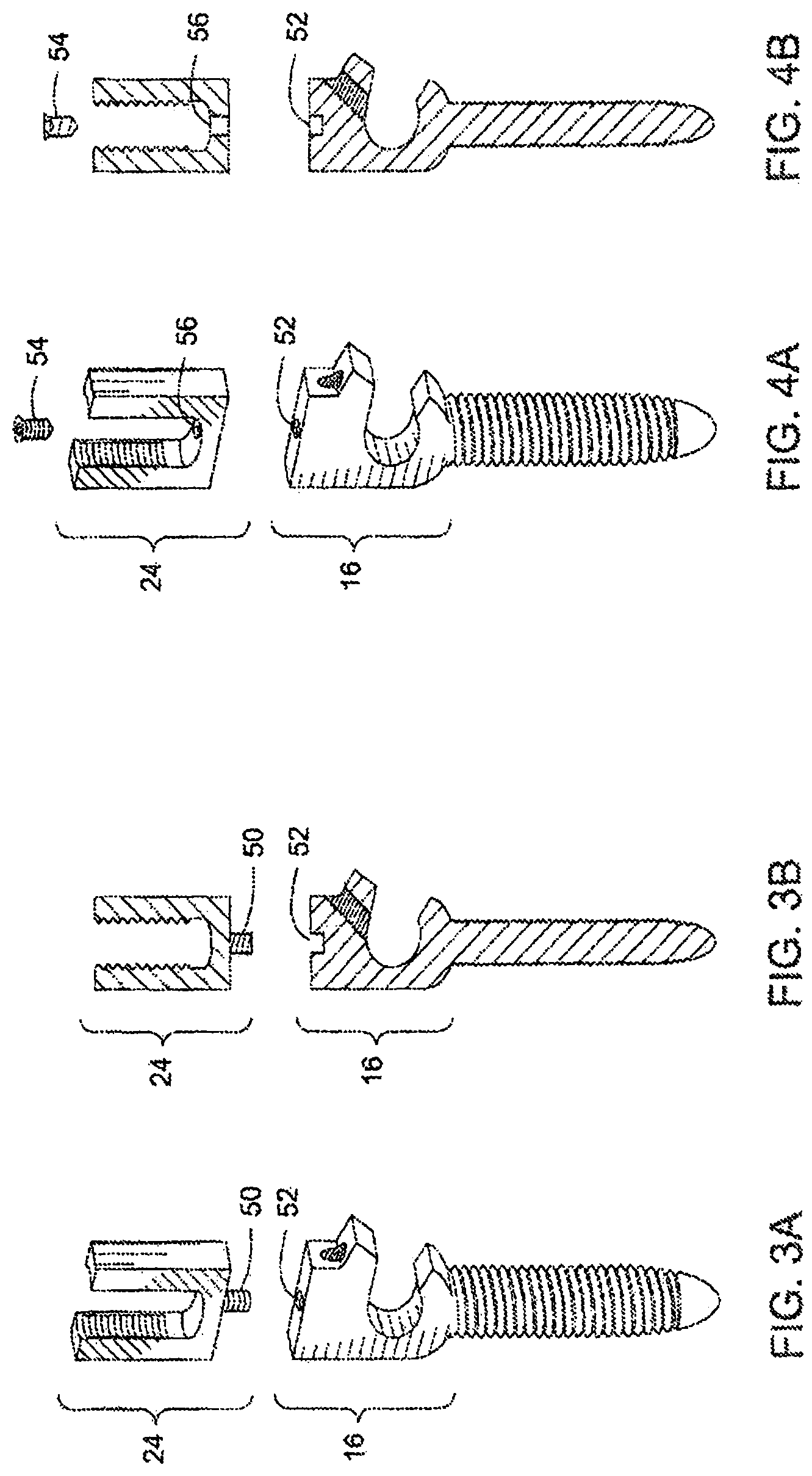 Patent US12303171 Figure 3 – Pedicle screw