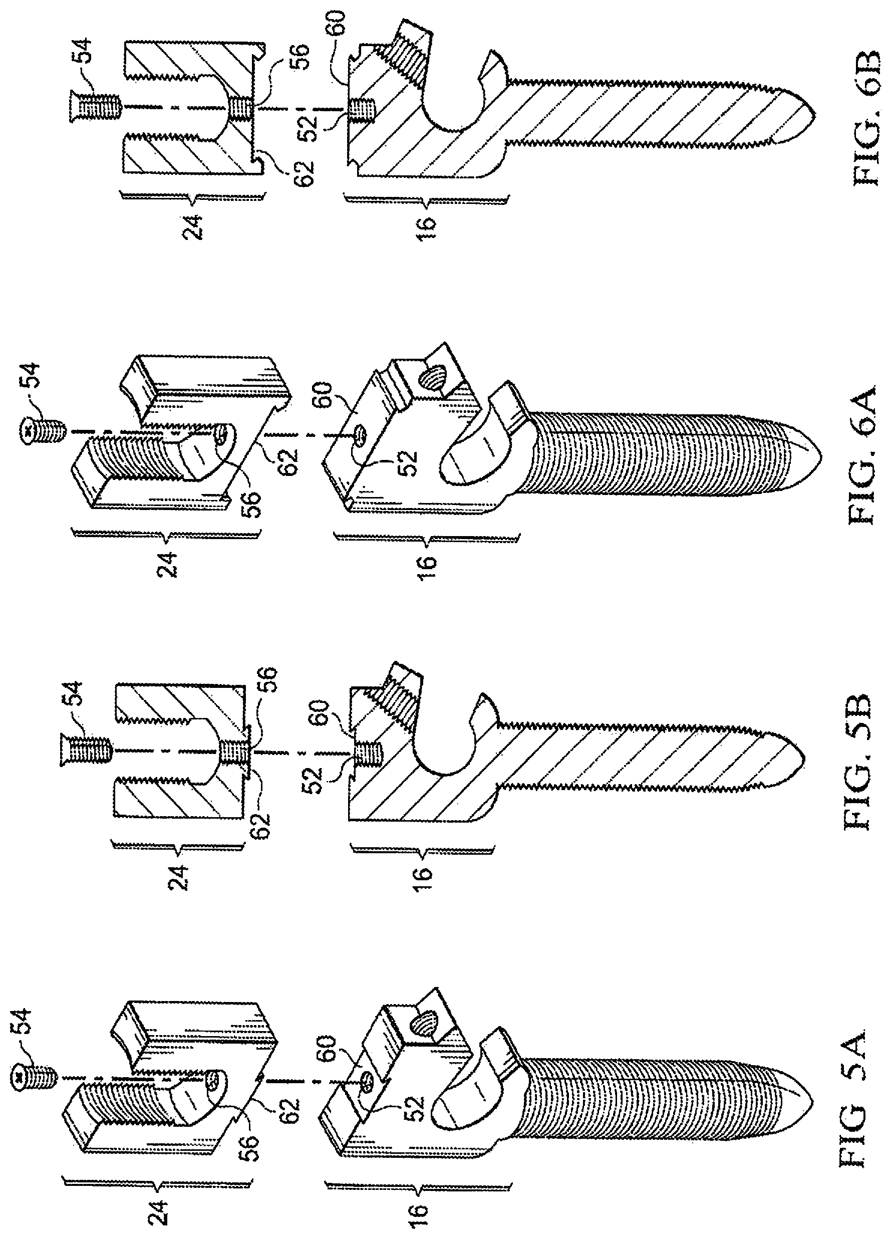Patent US12303171 Figure 4 – Pedicle screw