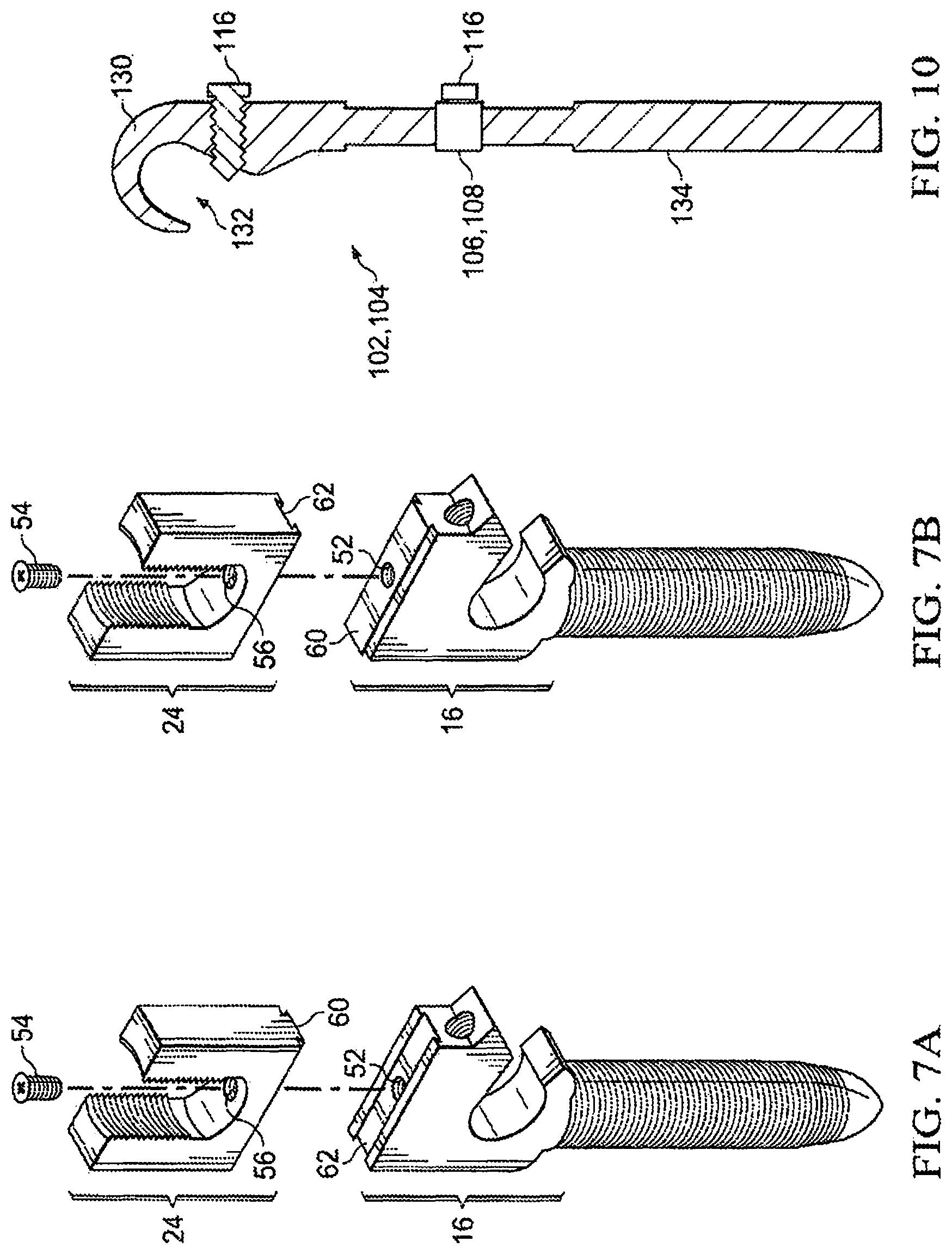 Patent US12303171 Figure 5 – Pedicle screw