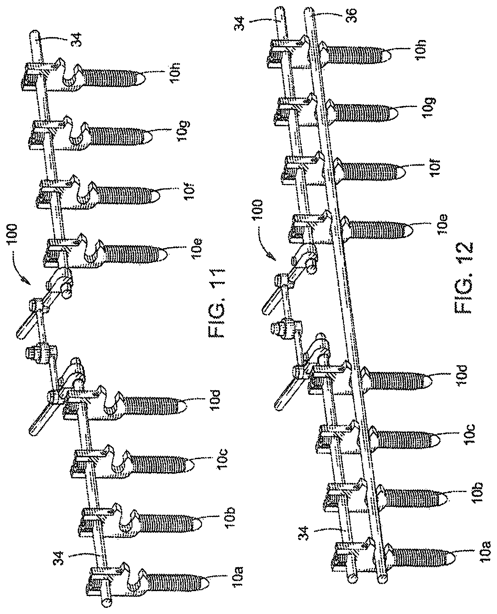 Patent US12303171 Figure 7 – Pedicle screw
