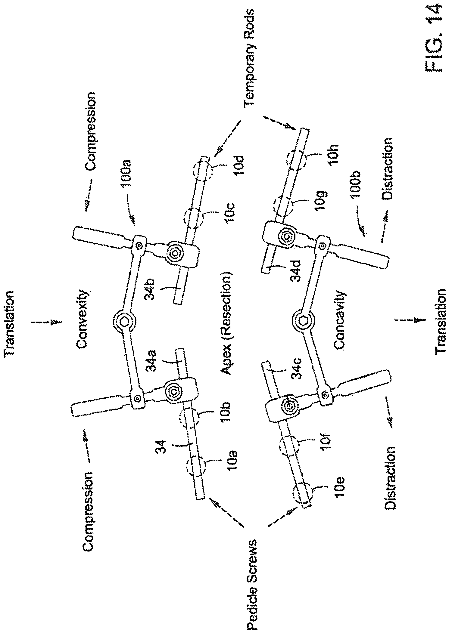 Patent US12303171 Figure 9 – Pedicle screw