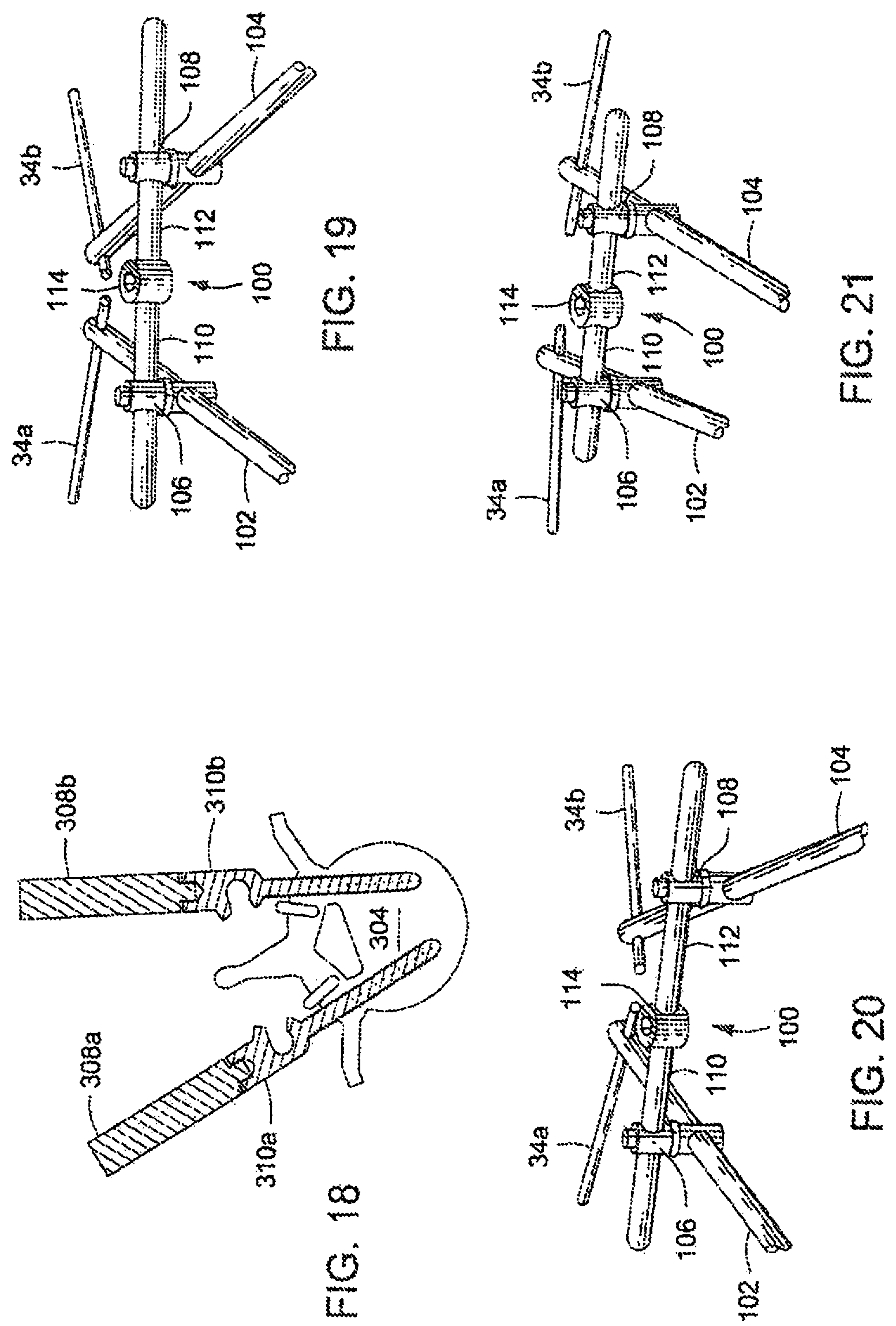 Patent US12303171 Figure 13 – Pedicle screw