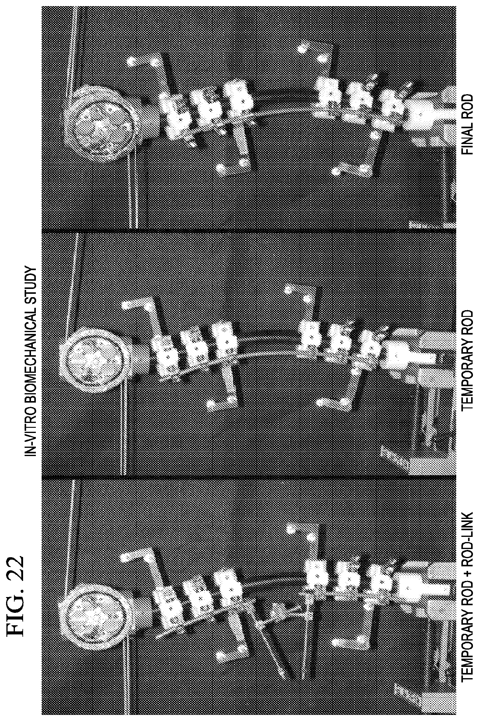 Patent US12303171 Figure 14 – Pedicle screw