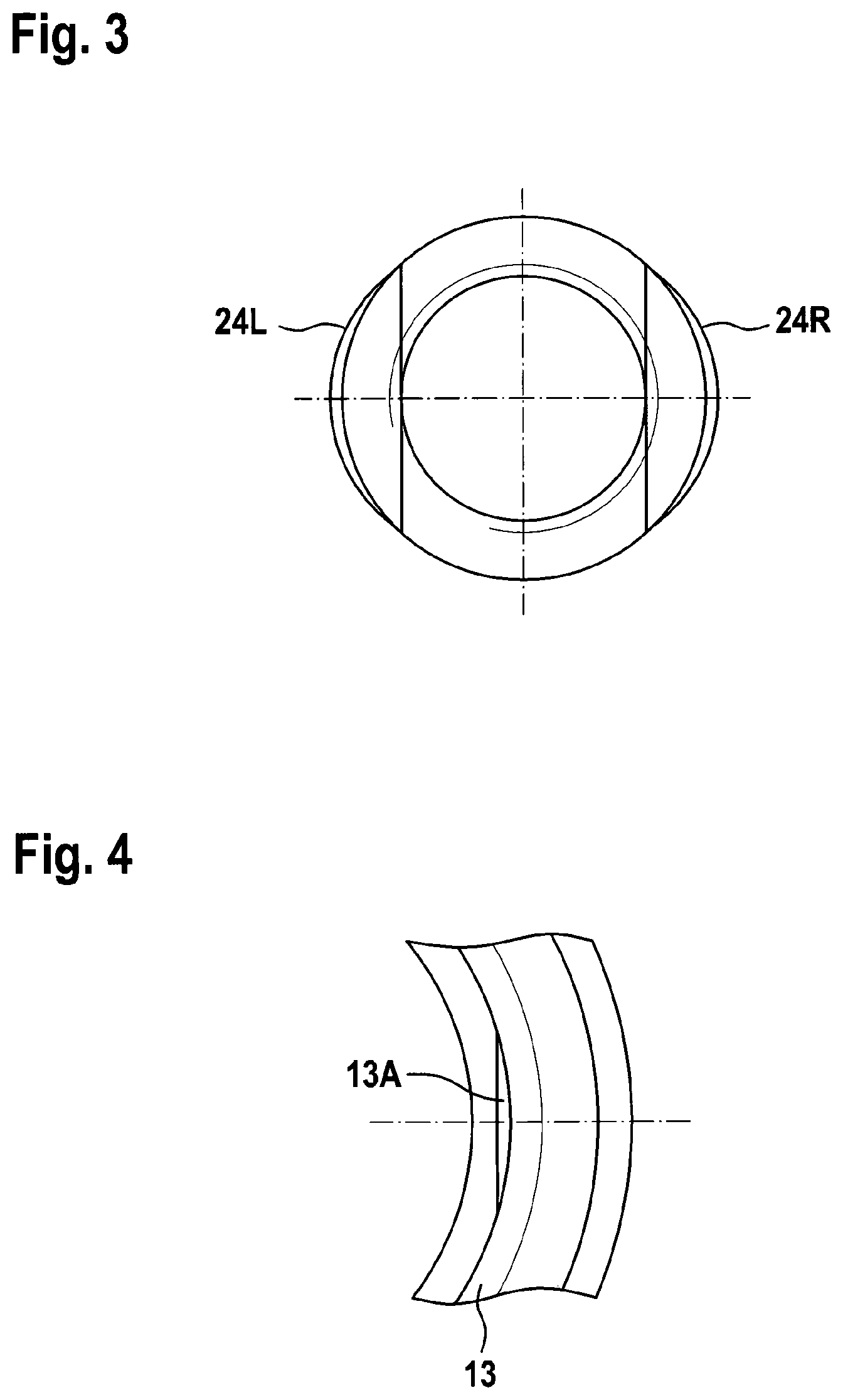 Patent US12303173 Figure 2 – Implant, in particular a spinal implant