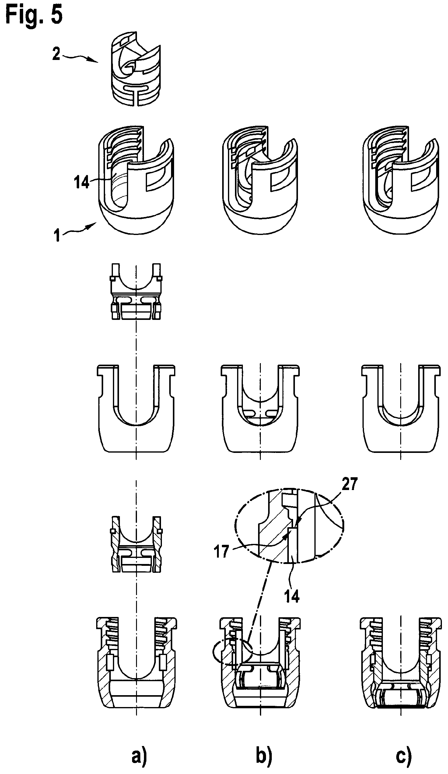 Patent US12303173 Figure 3 – Implant, in particular a spinal implant