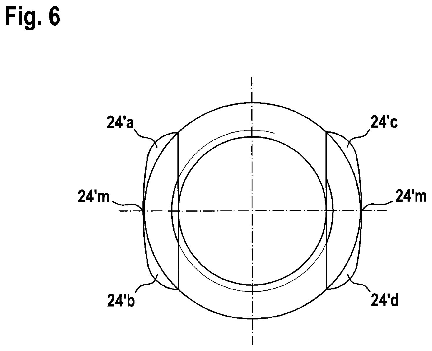 Patent US12303173 Figure 4 – Implant, in particular a spinal implant