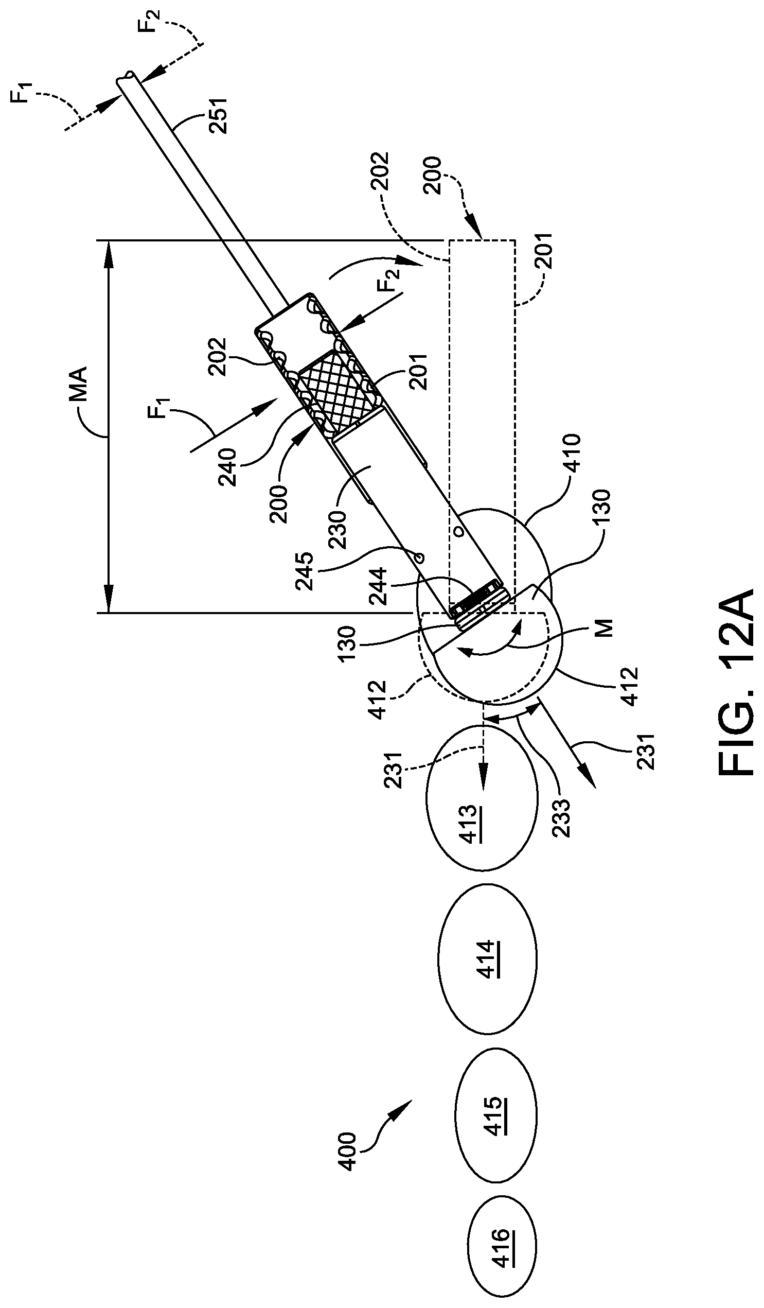 Patent US12303174 Figure 7 – Implant with intramedullary portion and variable angle extramedullary portion