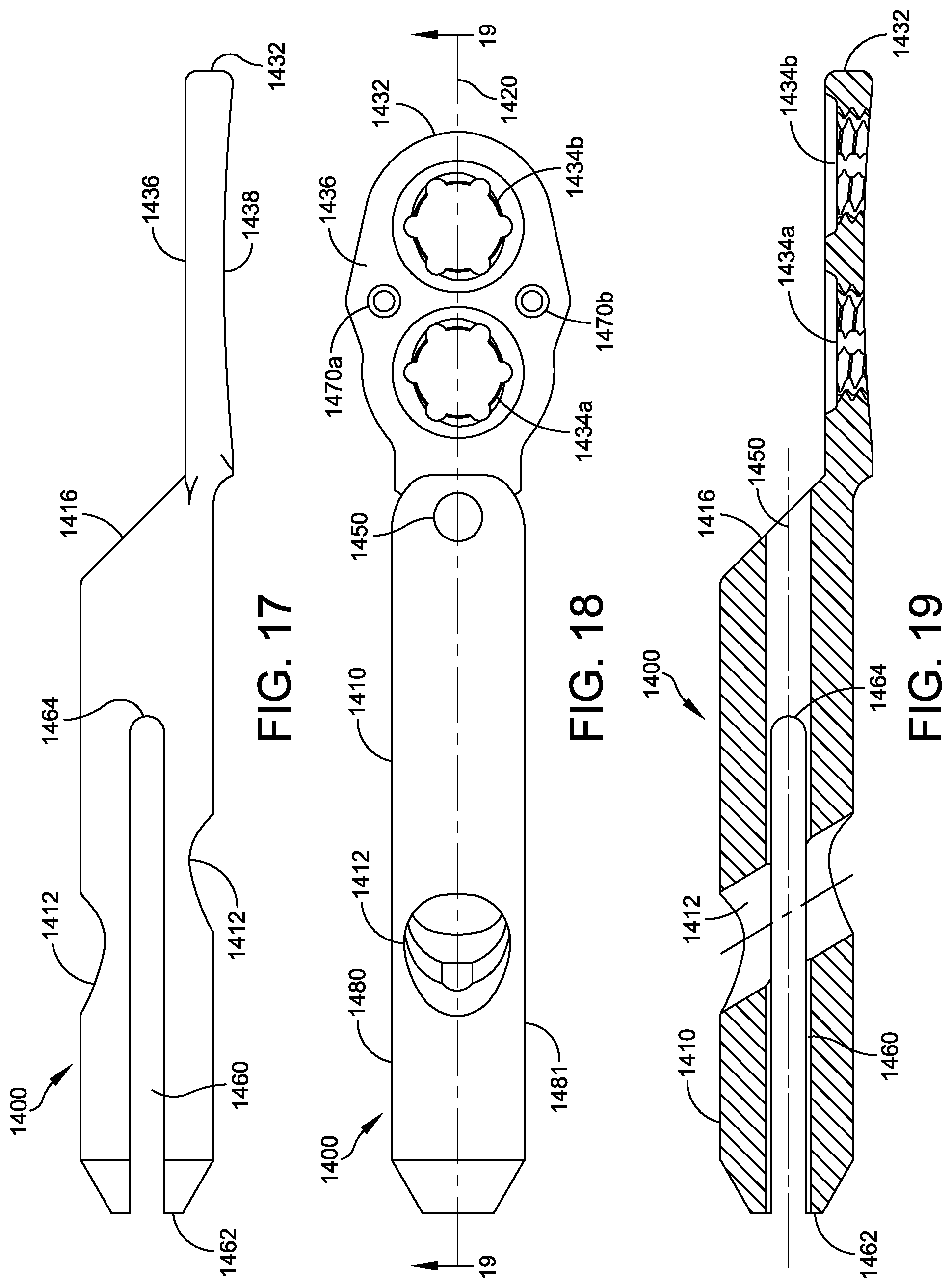 Patent US12303174 Figure 12 – Implant with intramedullary portion and variable angle extramedullary portion