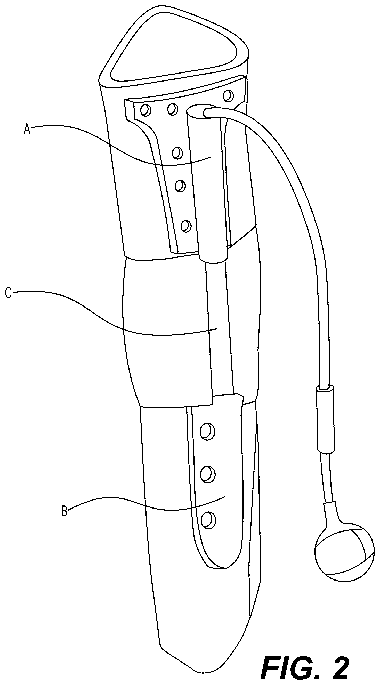 Patent US12303175 Figure 2 – Extramedullary internal bone lengthening and fixation device with dynamic axial stabilization