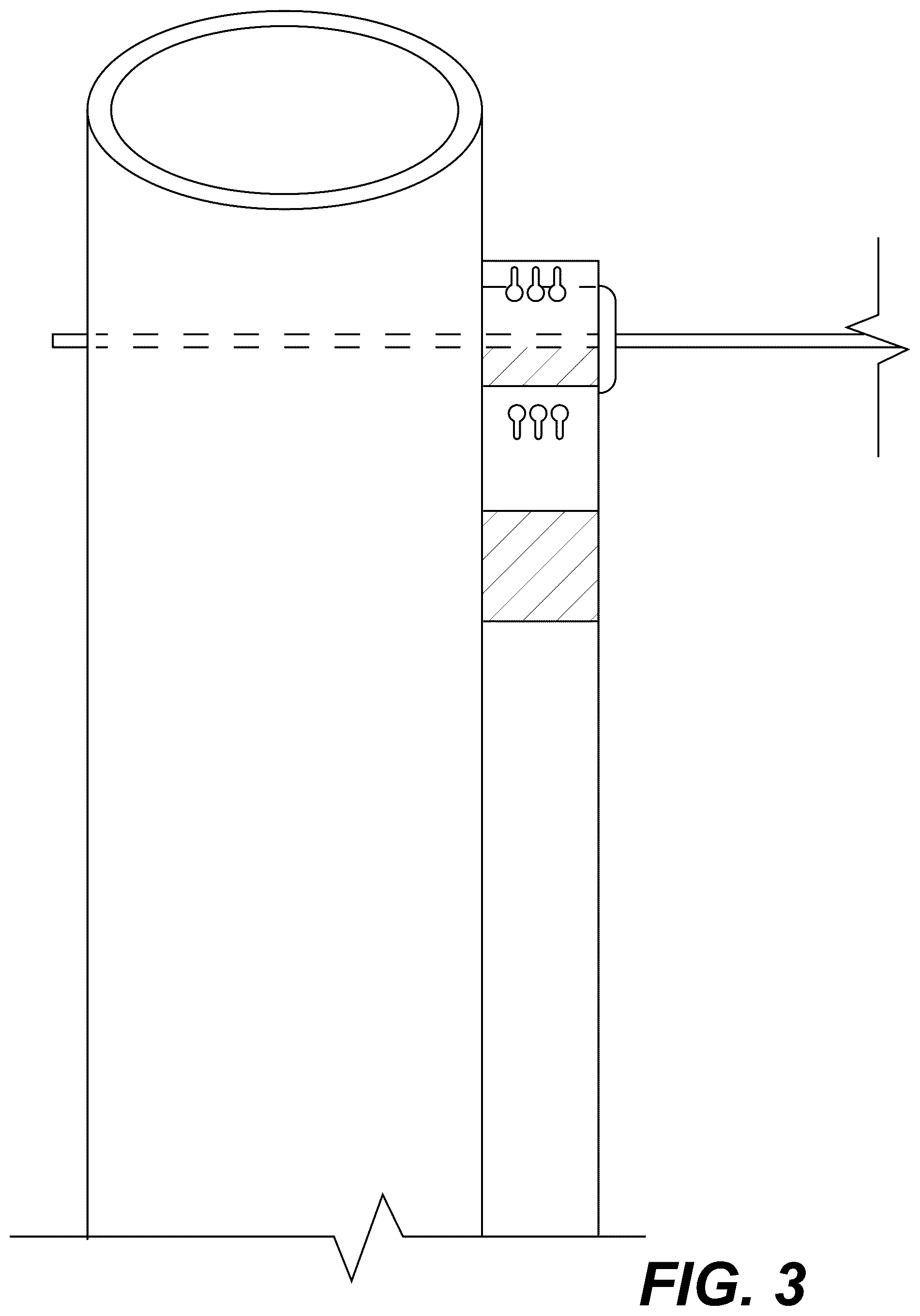 Patent US12303175 Figure 3 – Extramedullary internal bone lengthening and fixation device with dynamic axial stabilization