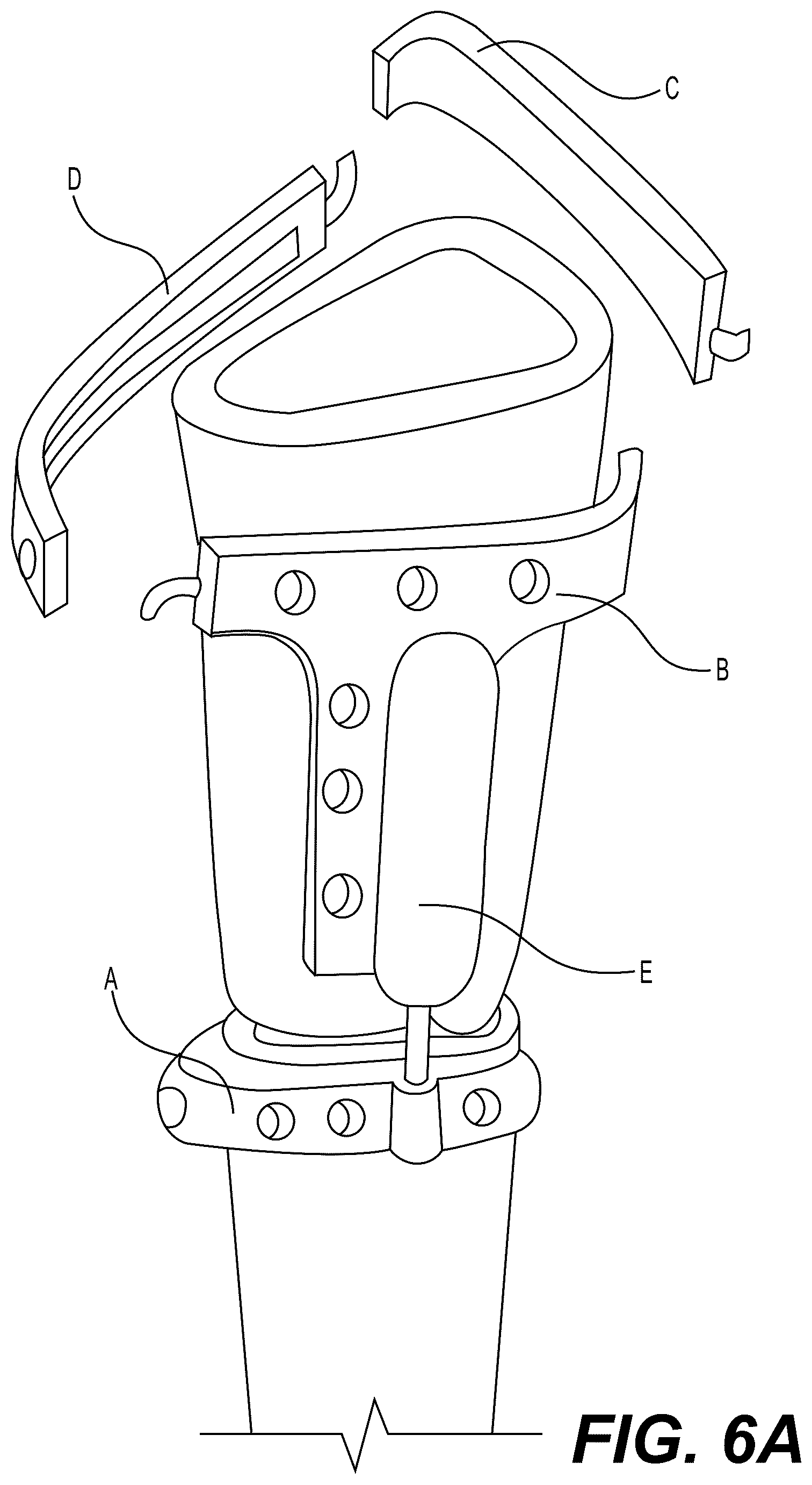 Patent US12303175 Figure 7 – Extramedullary internal bone lengthening and fixation device with dynamic axial stabilization