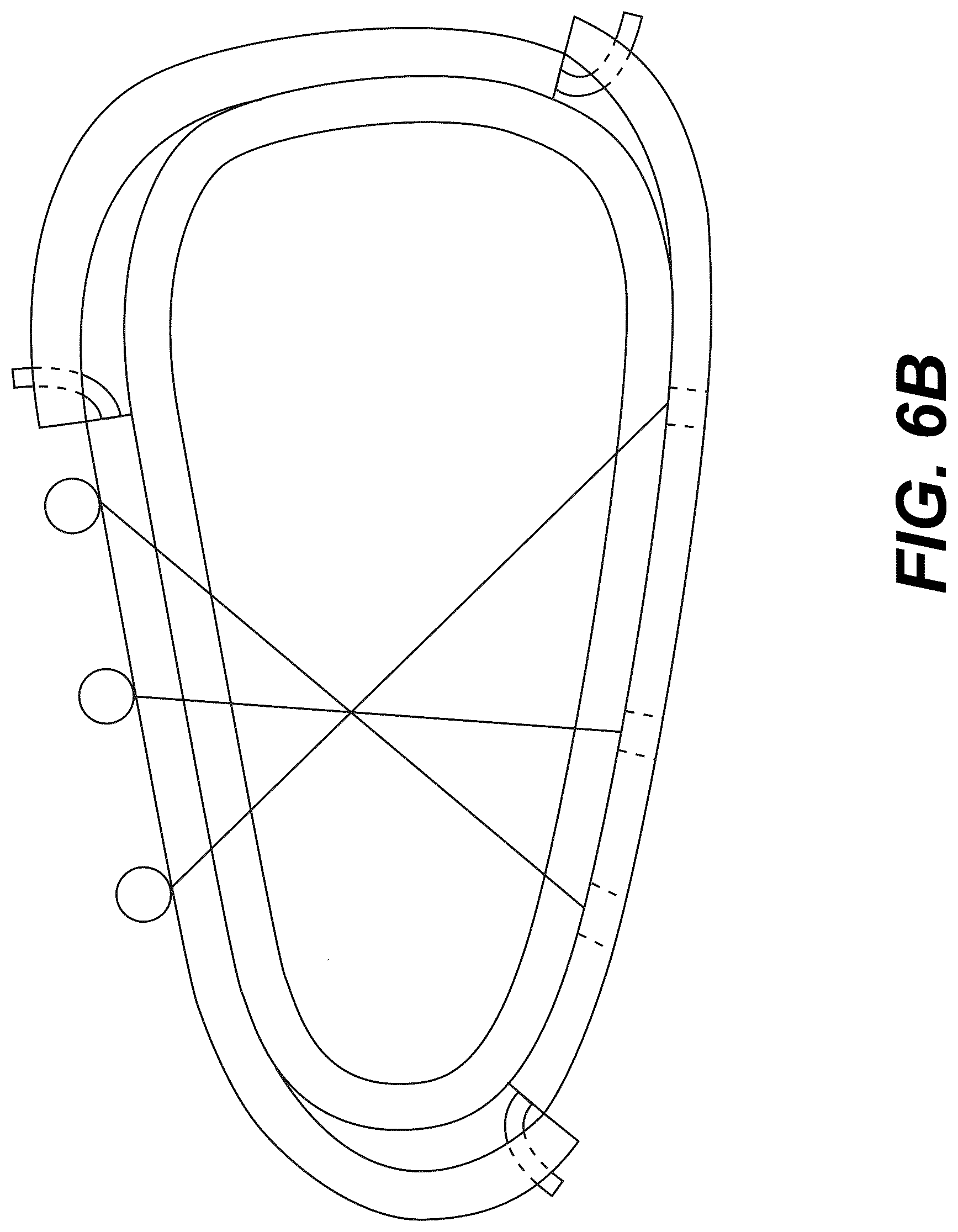 Patent US12303175 Figure 8 – Extramedullary internal bone lengthening and fixation device with dynamic axial stabilization