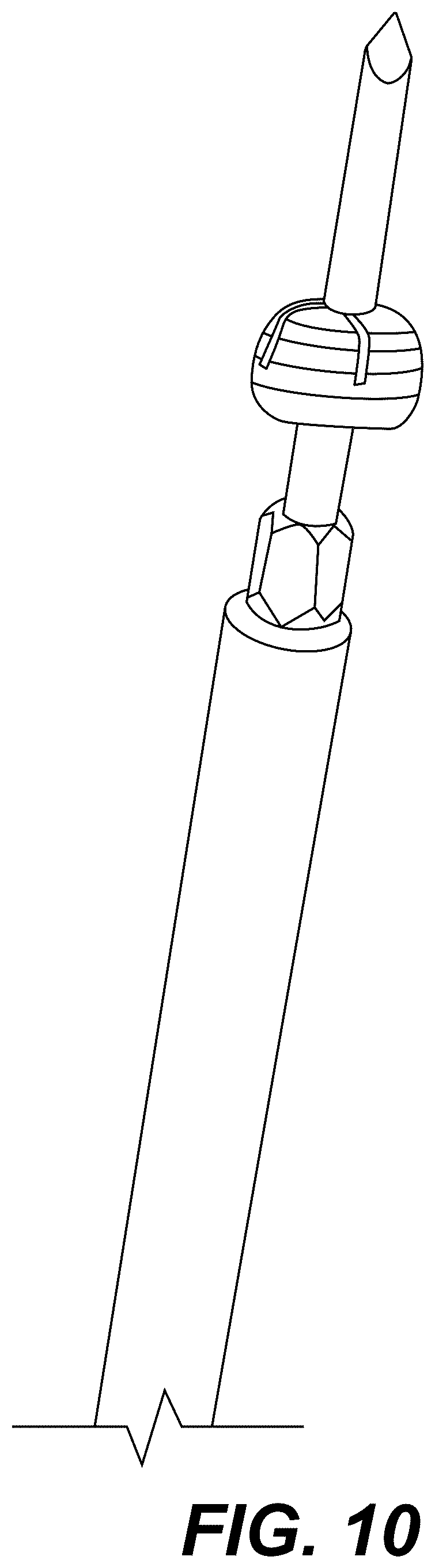 Patent US12303175 Figure 16 – Extramedullary internal bone lengthening and fixation device with dynamic axial stabilization