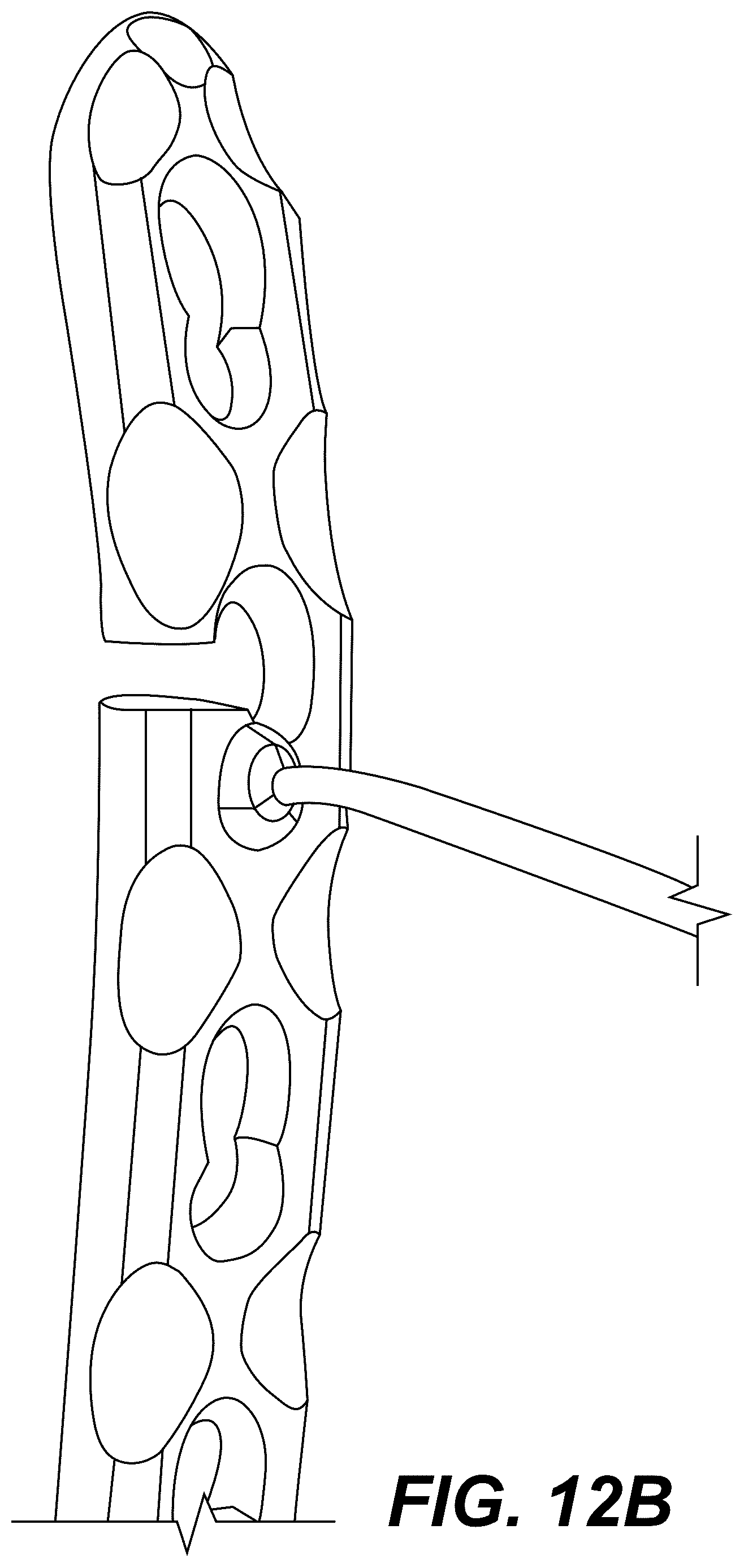 Patent US12303175 Figure 20 – Extramedullary internal bone lengthening and fixation device with dynamic axial stabilization
