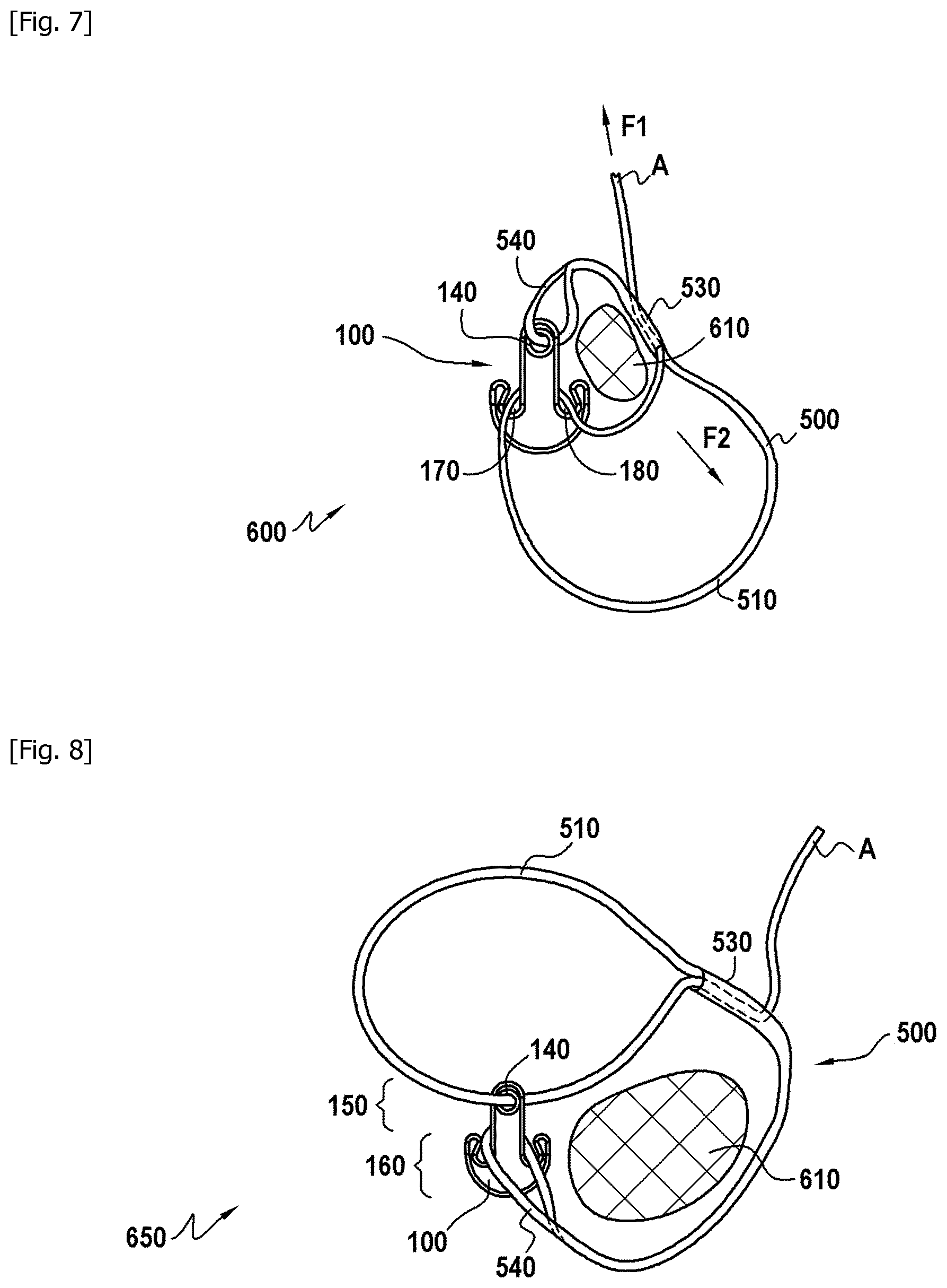 Patent US12303176 Figure 4 – Strapping device for stabilising a periprosthetic fracture
