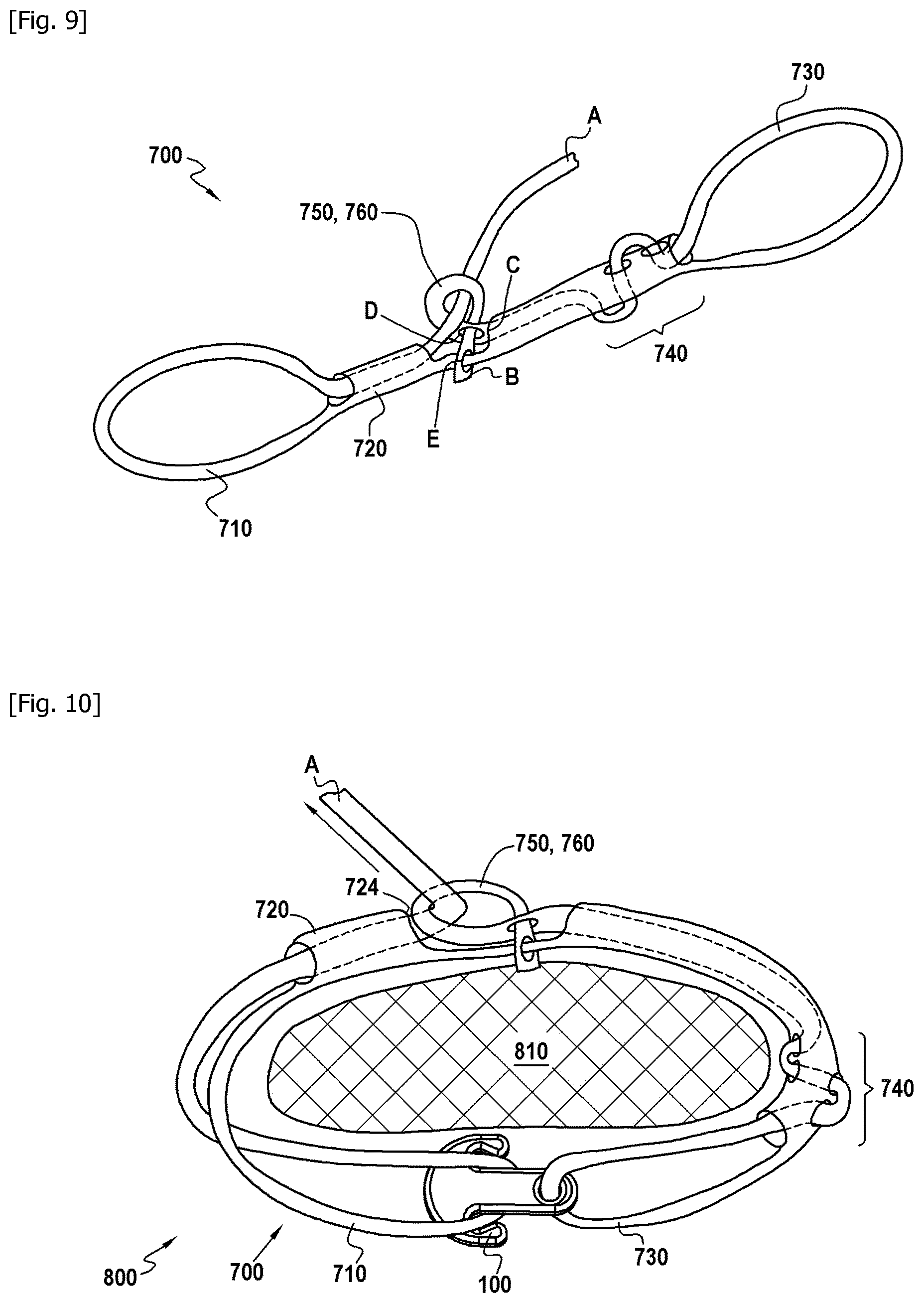 Patent US12303176 Figure 5 – Strapping device for stabilising a periprosthetic fracture