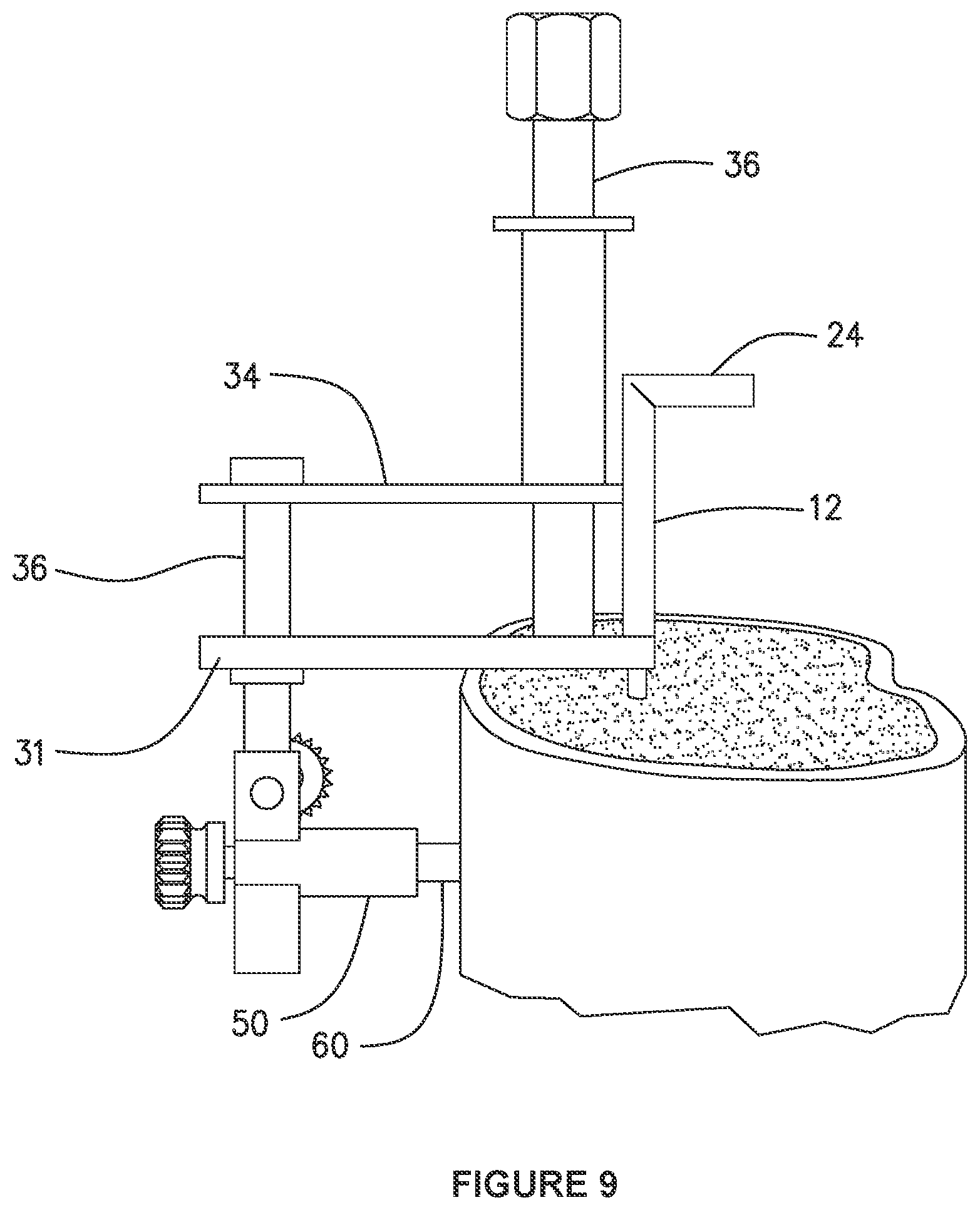 Patent US12303178 Figure 9 – Systems and methods for determining the cure of PMMA intraoperatively after implantation of an orthopedic device