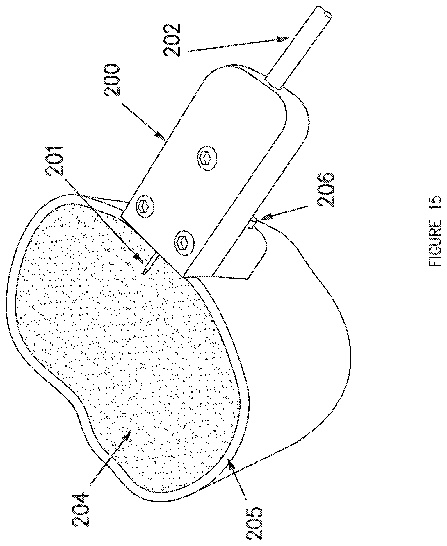 Patent US12303178 Figure 15 – Systems and methods for determining the cure of PMMA intraoperatively after implantation of an orthopedic device