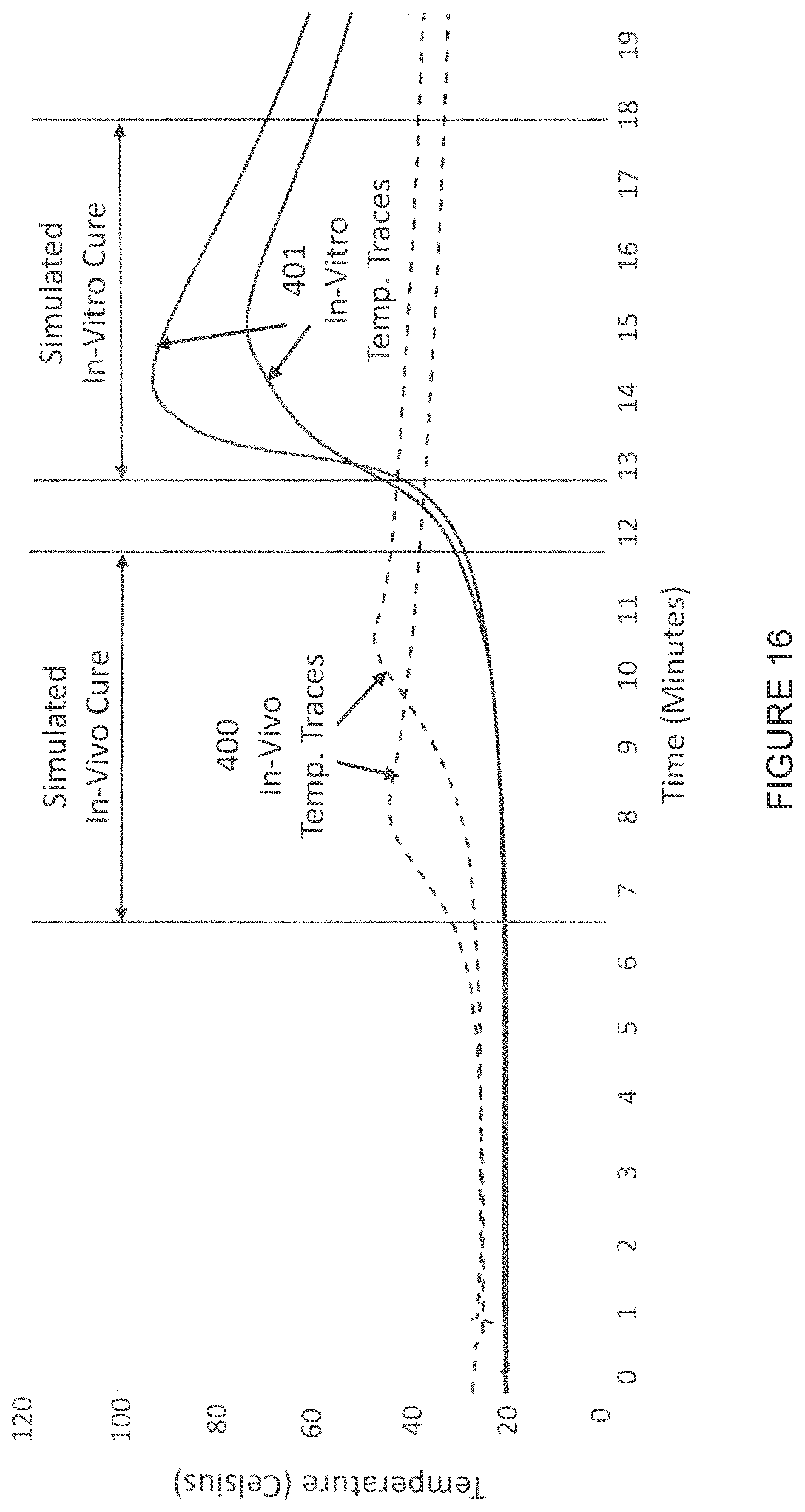 Patent US12303178 Figure 16 – Systems and methods for determining the cure of PMMA intraoperatively after implantation of an orthopedic device