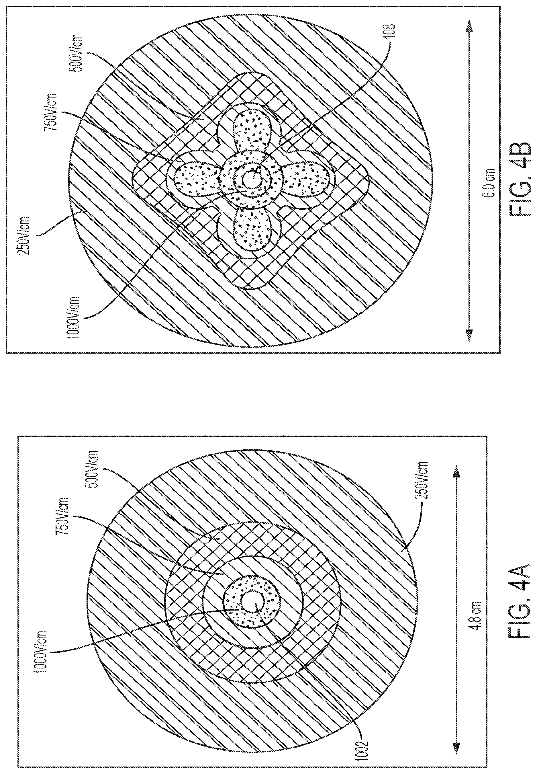 Patent US12303182 Figure 4 – Techniques for irreversible electroporation using a single-pole tine-style internal device communicating with an external surface electrode