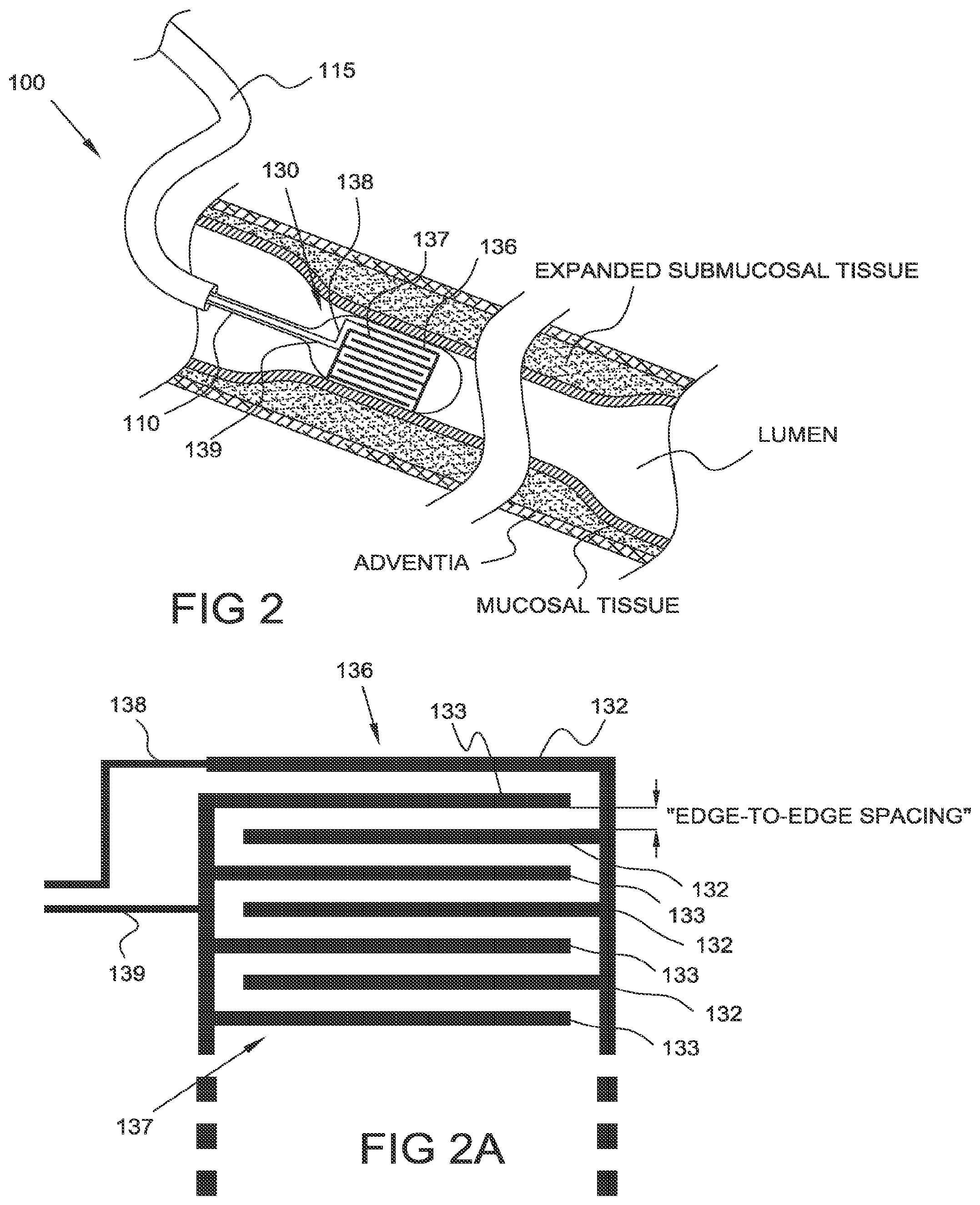 Patent US12303185 Figure 2 – Electrical energy ablation systems, devices and methods for the treatment of tissue