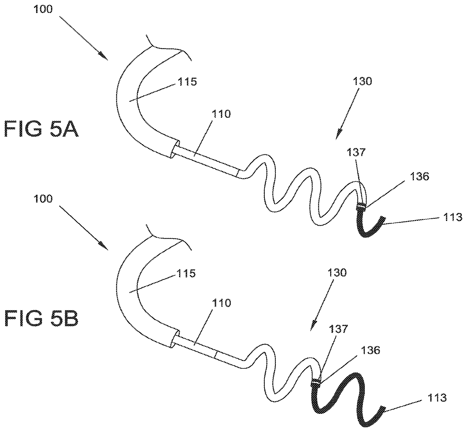 Patent US12303185 Figure 5 – Electrical energy ablation systems, devices and methods for the treatment of tissue