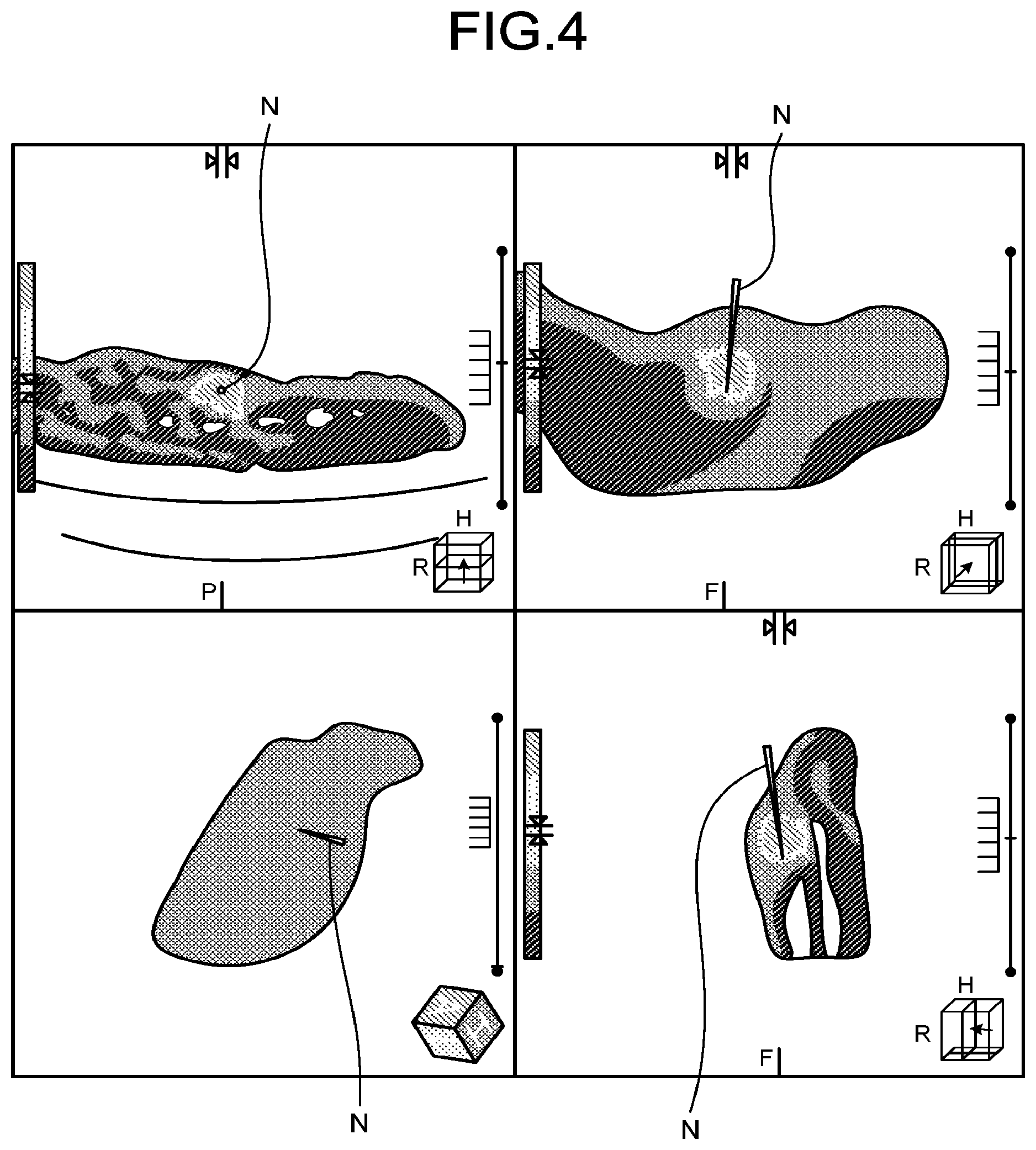 Patent US12303187 Figure 4 – Medical image processing apparatus