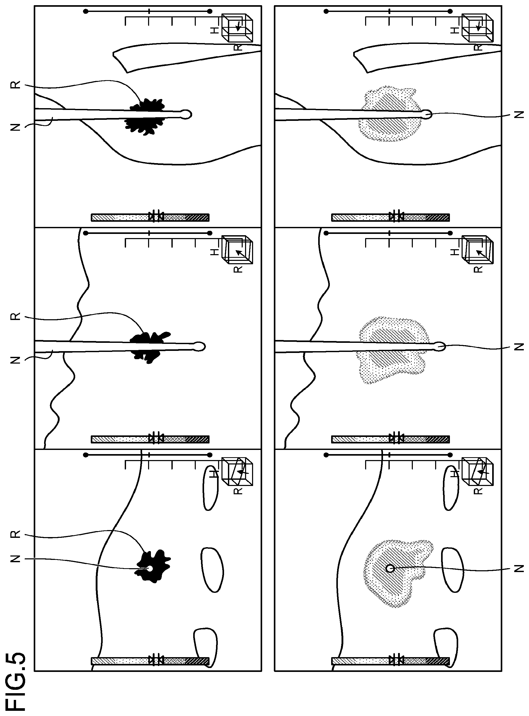 Patent US12303187 Figure 5 – Medical image processing apparatus