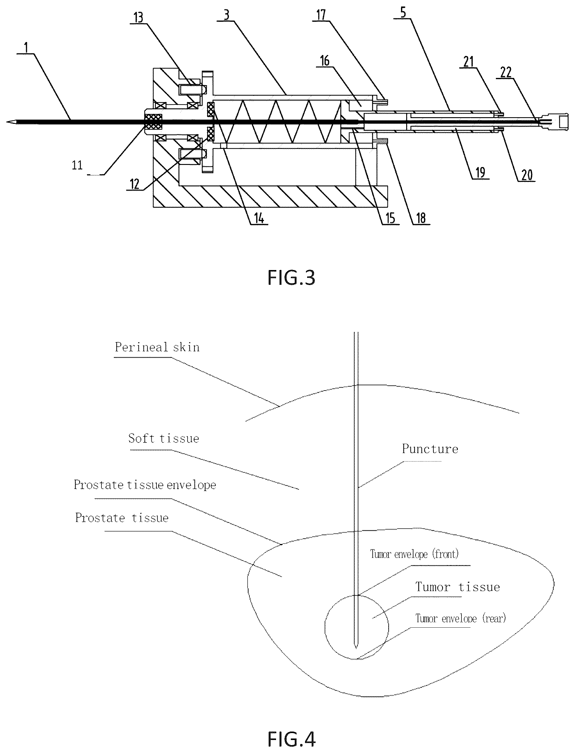 Patent US12303188 Figure 2 – Electric pulse ablation device and simulation method applicable to the same