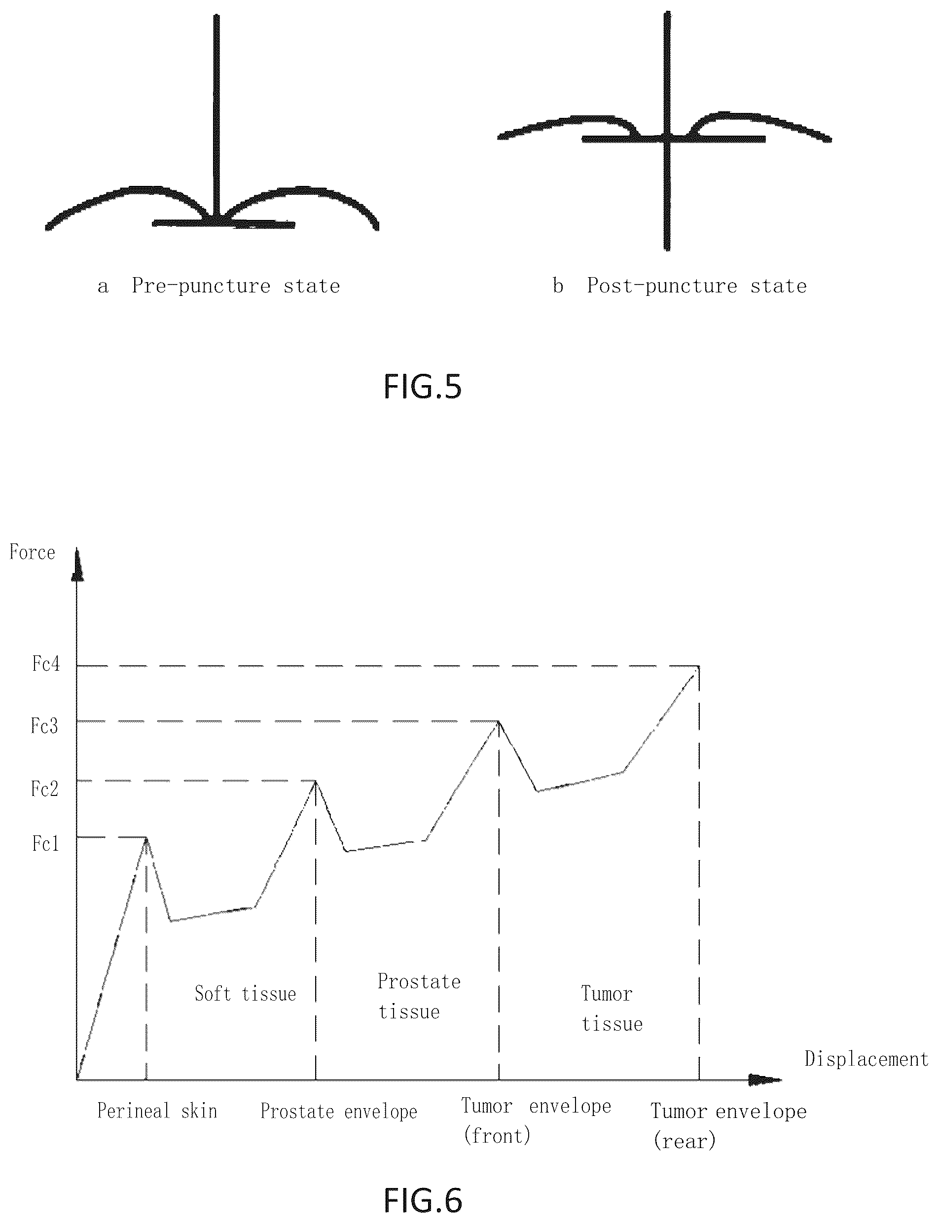 Patent US12303188 Figure 3 – Electric pulse ablation device and simulation method applicable to the same