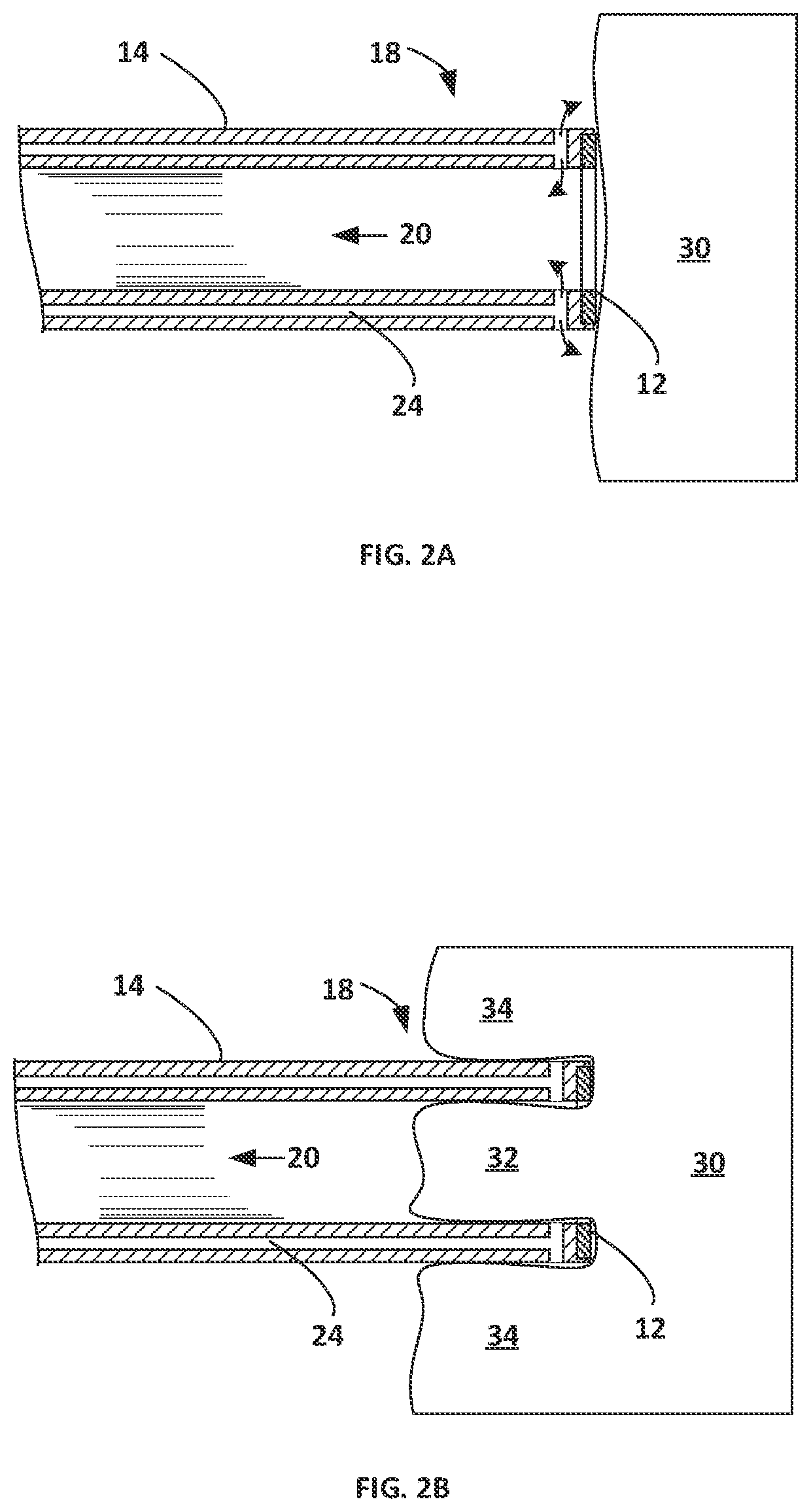 Patent US12303189 Figure 2 – Energized corers with energized internals