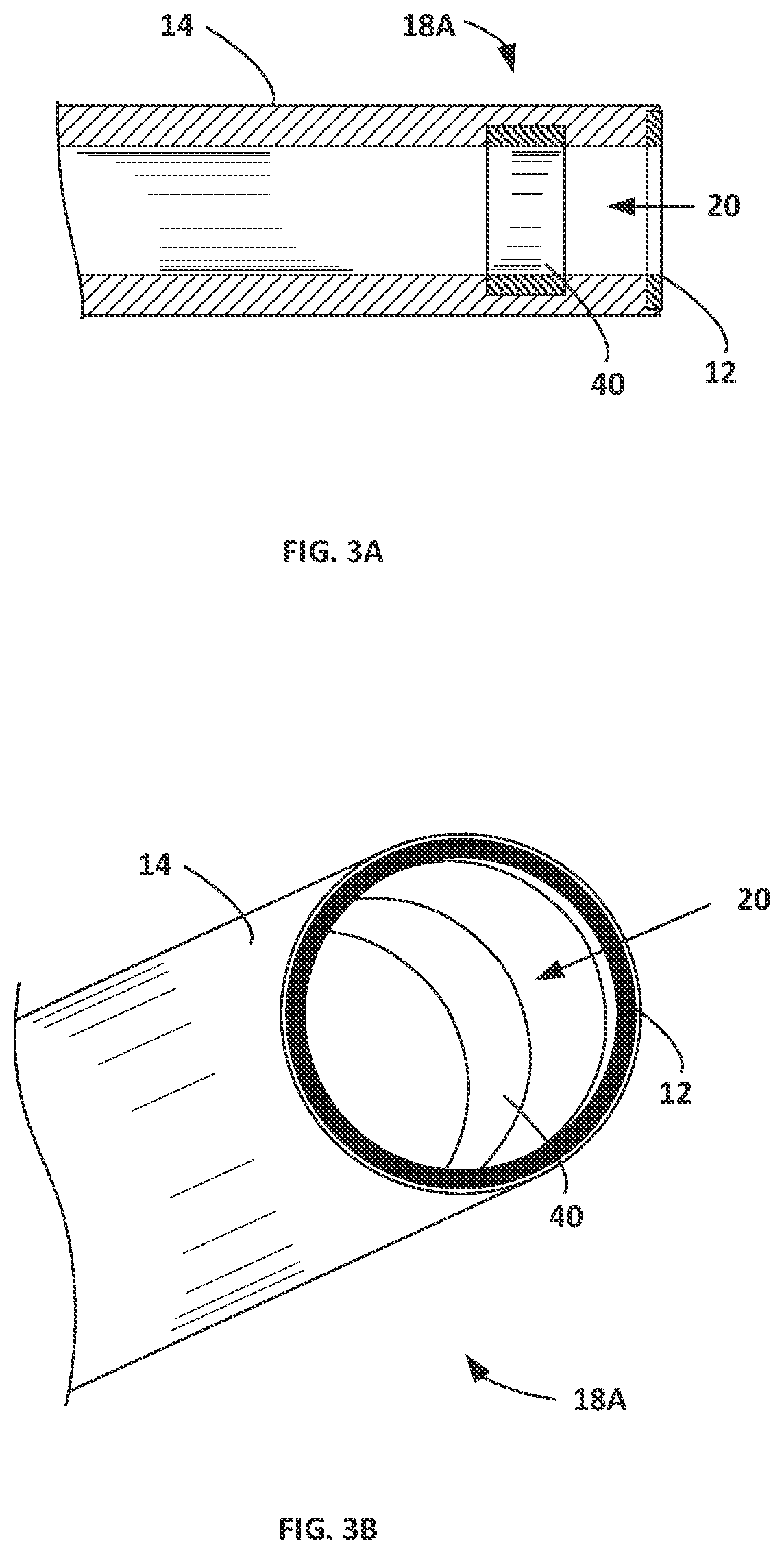 Patent US12303189 Figure 3 – Energized corers with energized internals