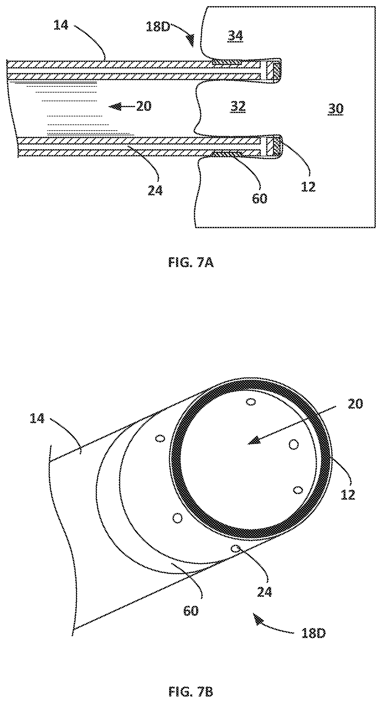 Patent US12303189 Figure 7 – Energized corers with energized internals