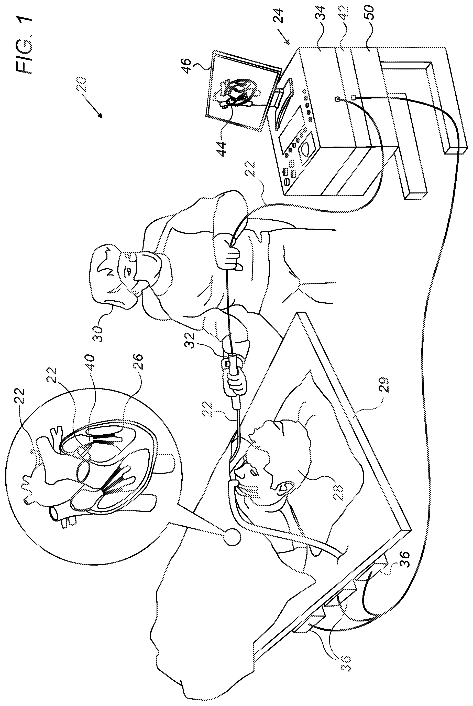 Patent US12303190 Figure 1 – Catheter distal end made of plastic tube and flexible printed circuit boards