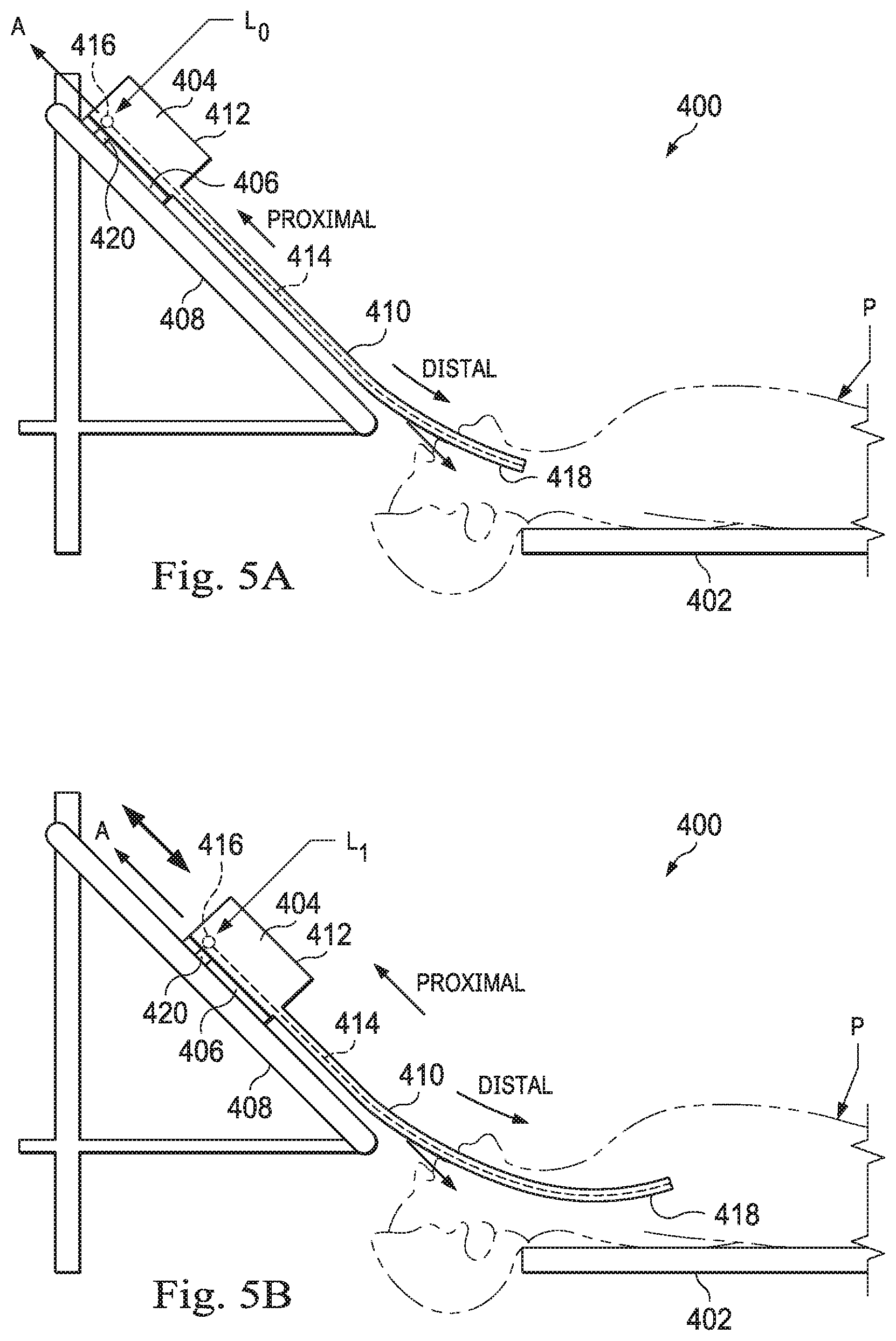 Patent US12303191 Figure 4 – Systems and methods for powering an antenna