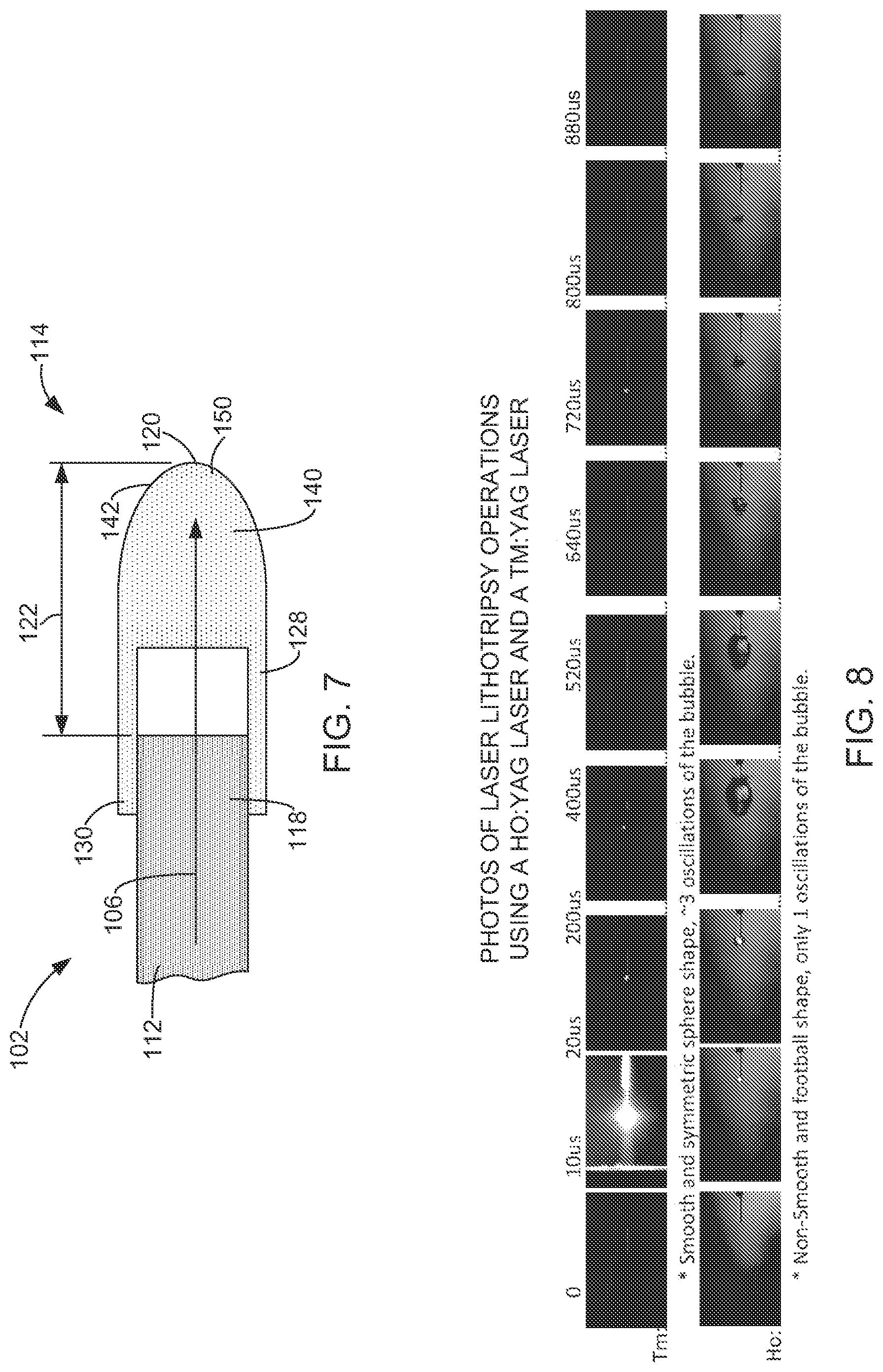 Patent US12303193 Figure 4 – Surgical laser systems and laser lithotripsy techniques