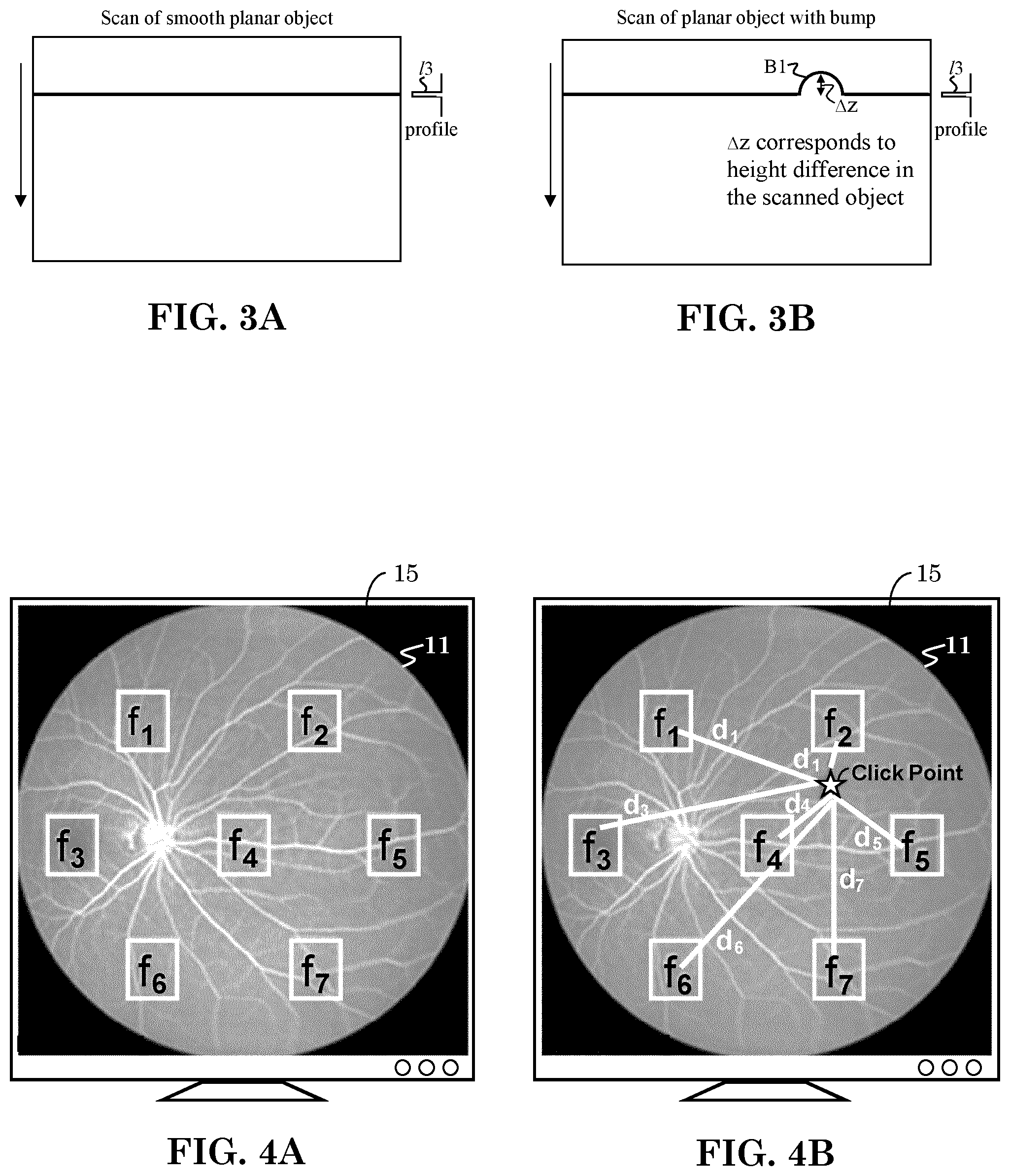 Patent US12303197 Figure 2 – Patient tuned ophthalmic imaging system with single exposure multi-type imaging, improved focusing, and improved angiography image sequence display